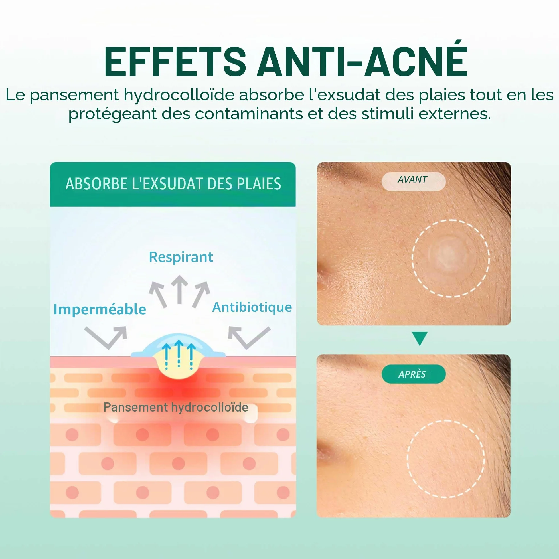SOMEBYMI 30 days Miracle Clear Spot Patches