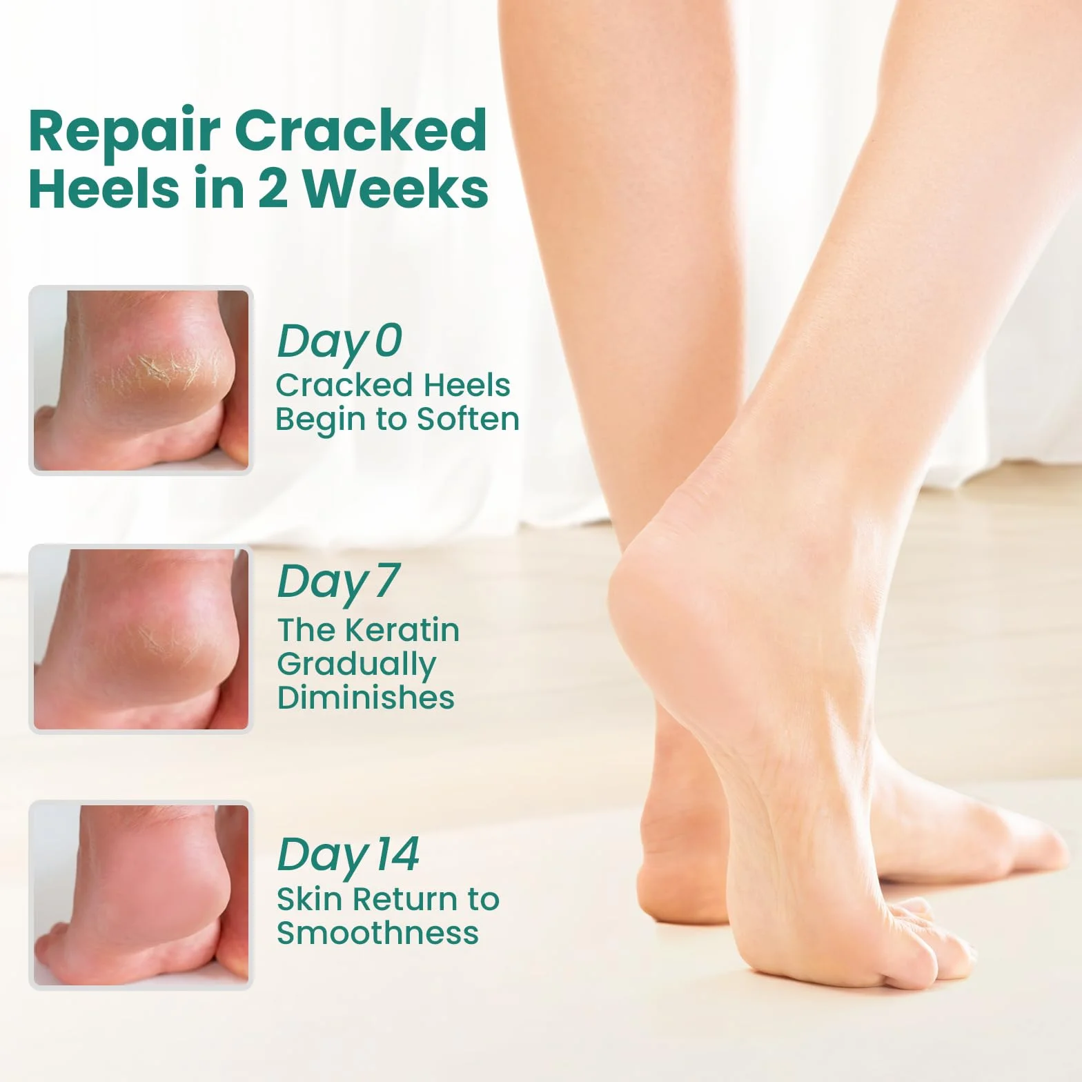 Welnove Lot de 2 paires de chaussettes hydratantes à talon Extrait d'aloe vera Doublure en gel pour pieds secs