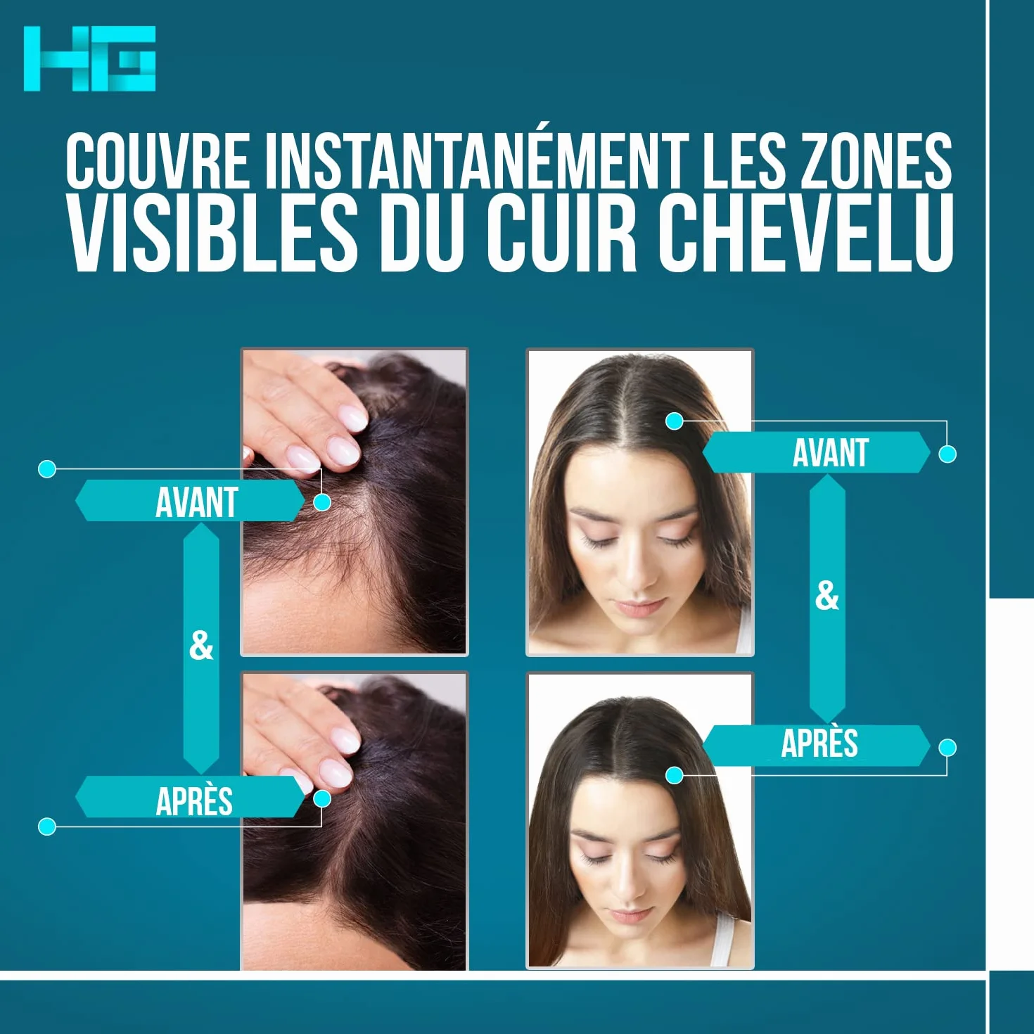 Hair Genetics Retouche Racines Cheveux - Coloration Cheveux Gris - Remplit les sourcils - Marron foncé