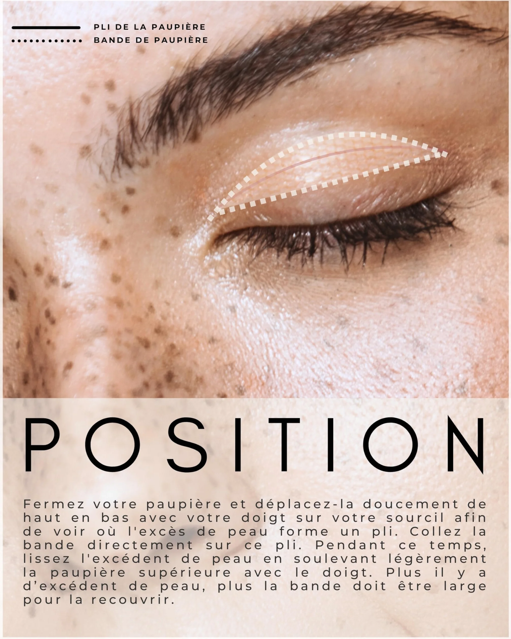 BOTÉ Patch paupière tombante 144 L - Bande rehausseur paupières invisible autocollant respirant - Eyelid lifting tape