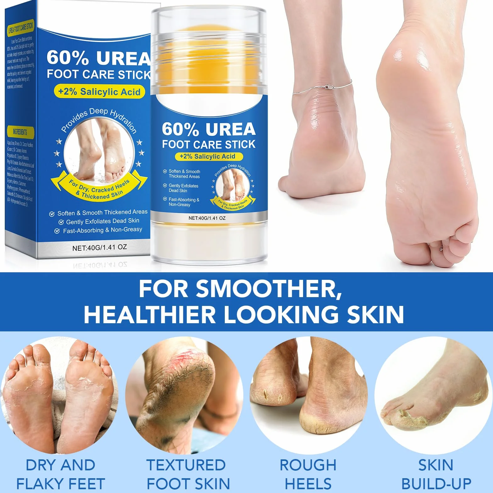 Urea Cream 60 Percent for Feet, Crème Réparatrice pour Peaux Très Sèches et Rugueuses (1PC)
