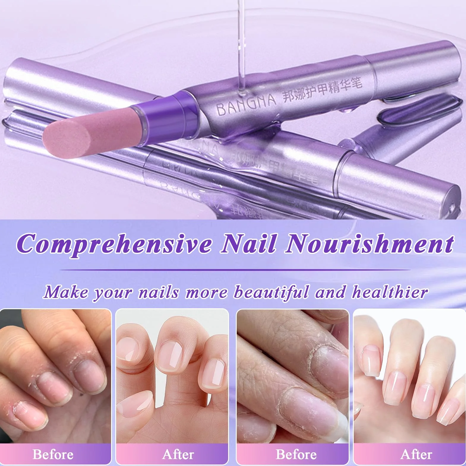 Lot de 2 bâtons de soin des ongles 3 en 1 - Stylo à huile pour cuticules - Réparation des fissures et ongles secs