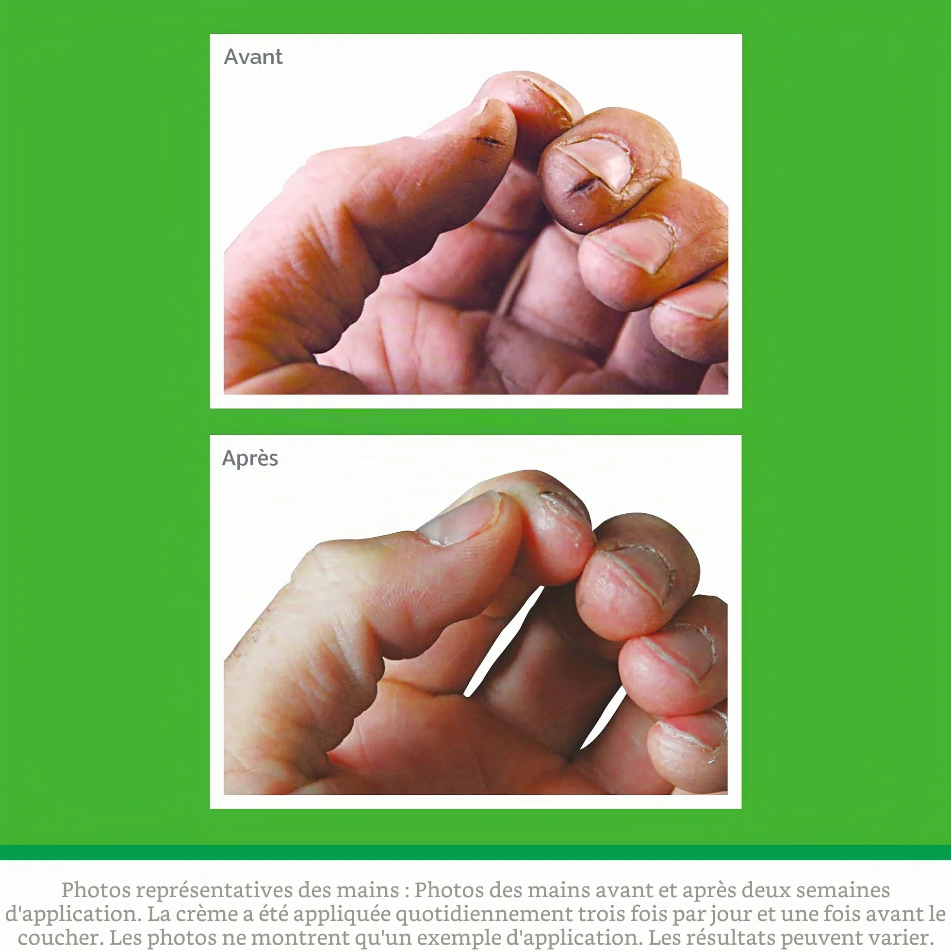 O'Keeffe's Working Hands Crème pour les mains extrêmement sèches 96 g lot de 2
