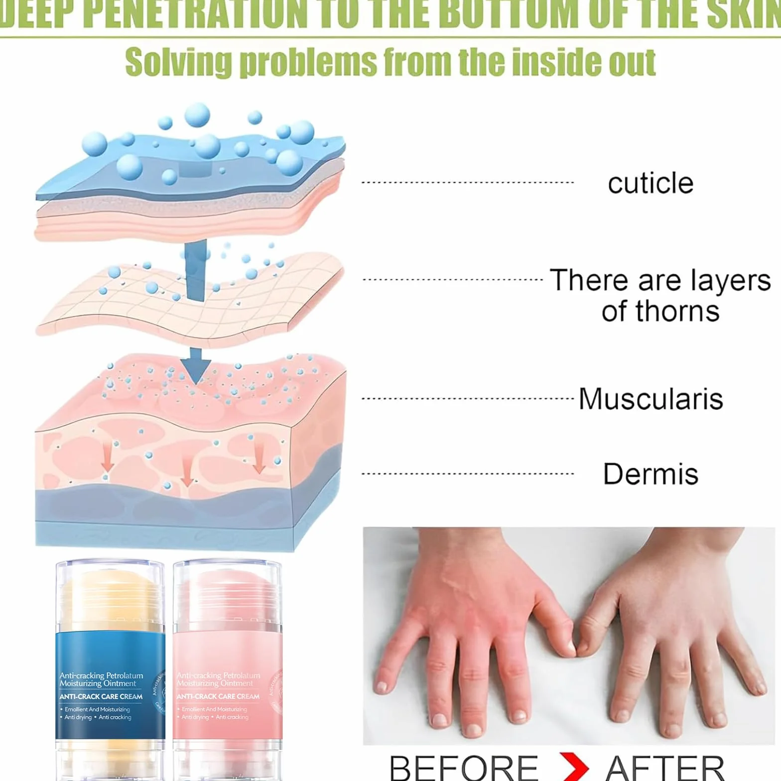 Crème pour les Pieds Hydratant Exfoliant Anti-Crevasses Guérir Pommade Peau d'Hiver