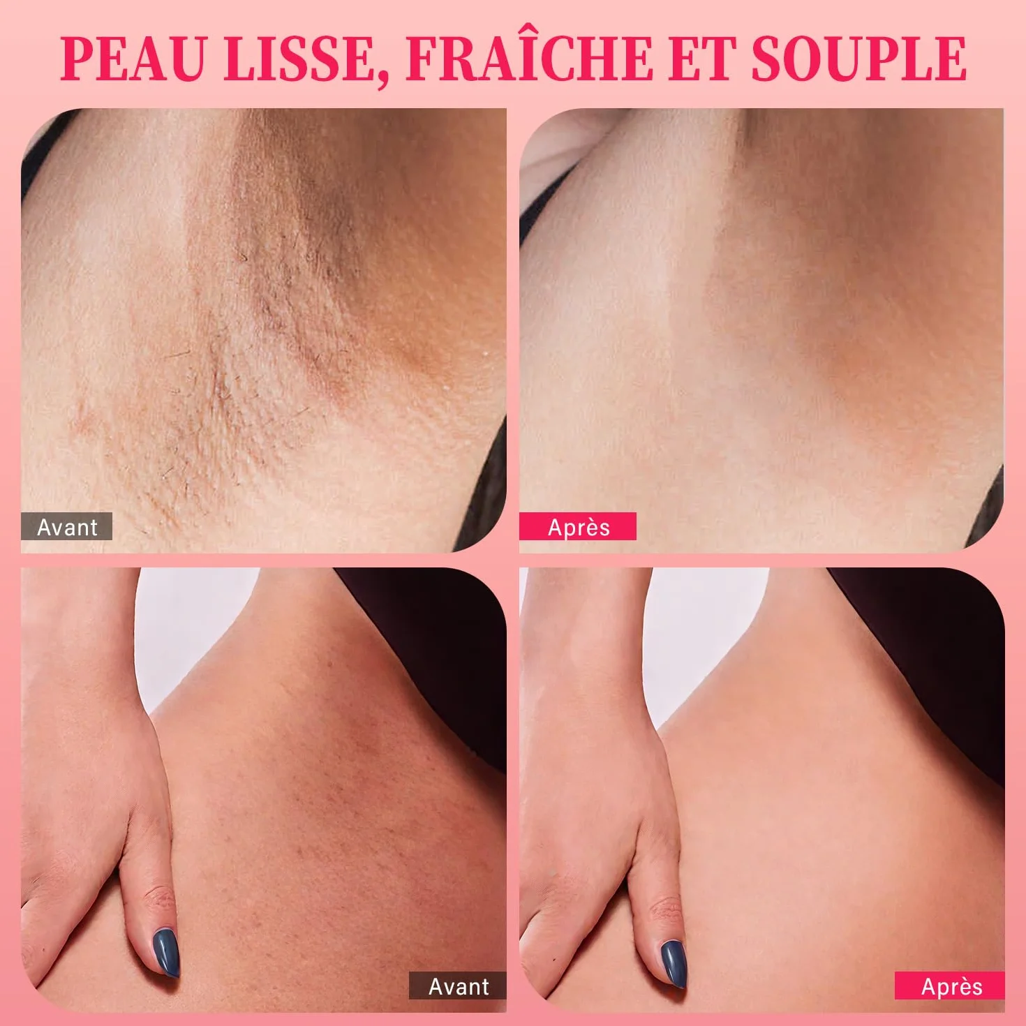 Gommage exfoliant maillot 10% AHA + BHA vitamine C 200g élimine poils incarnés taches brunes