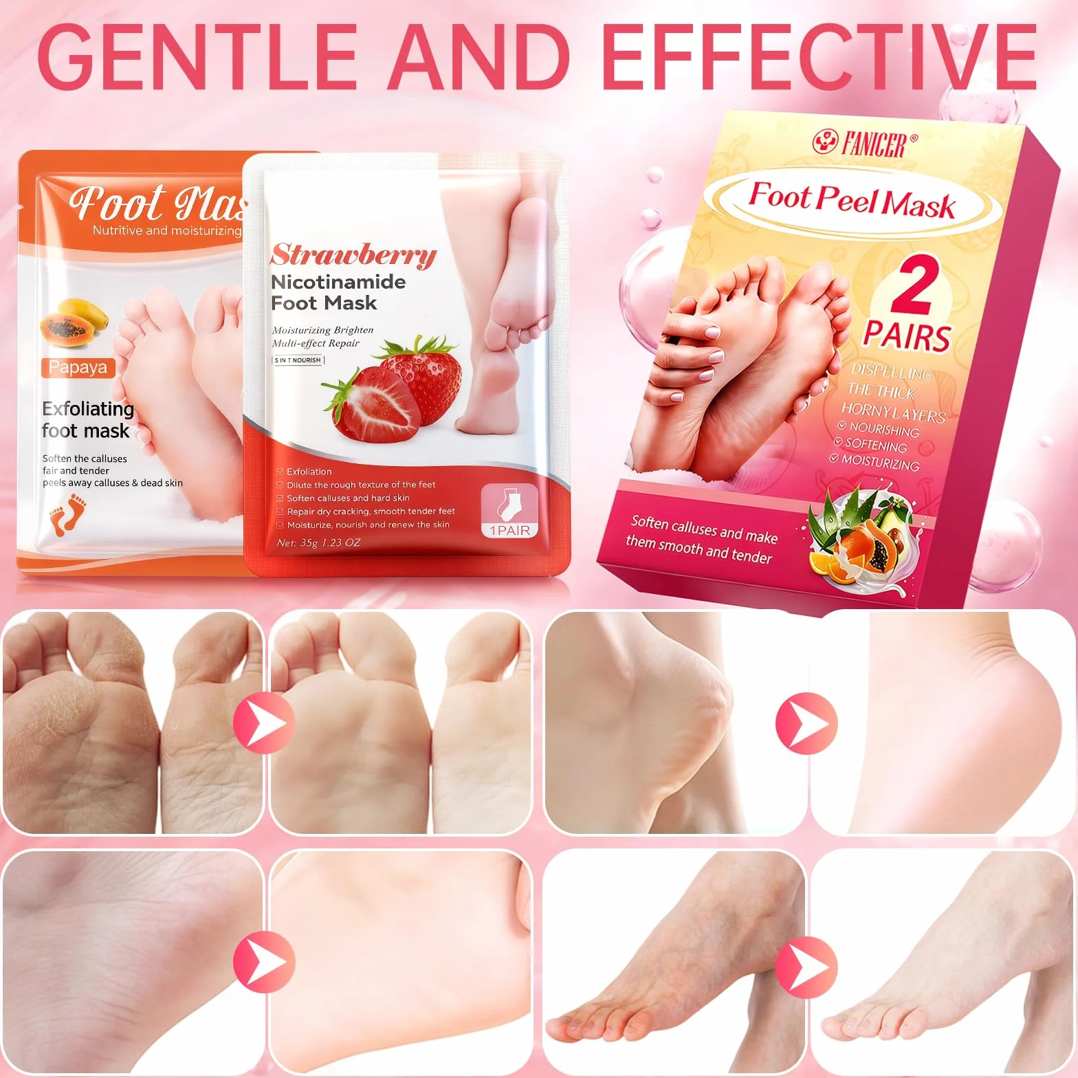 Masque Pied Exfoliant 2 Paires, Chaussette Exfoliante Pieds Secs, Hydratation Profonde