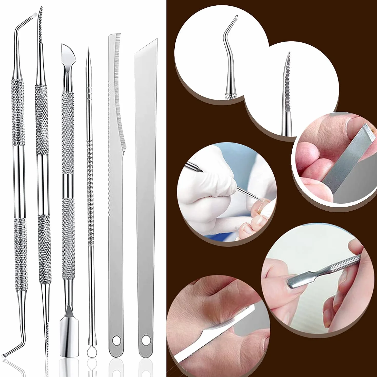Kit de Traitement des Ongles Incarnés – Pince à Ongles Incarnés et Outils de Correction en Acier Inoxydable