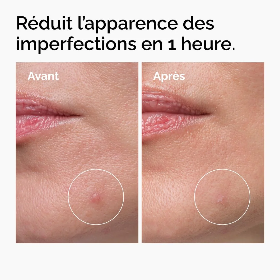 The Ordinary Soufre 10% Crème-en-Poudre Traitement imperfections 5 g