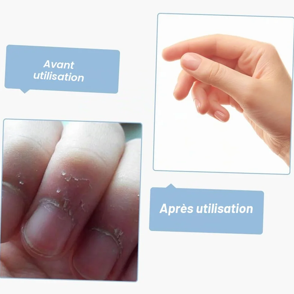 Cuticule à Ongles Fourches 6 Pcs Double Tête Pousseurs Cuticulaires Nail Art Manucure Pédicure