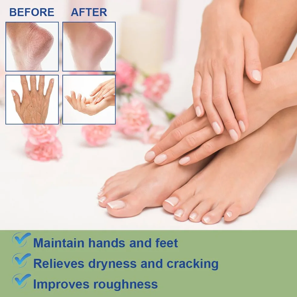 ACWOO Crème à l'Urée 60% Pieds Réparatrice Hydratante pour Pieds Secs et Fissurés