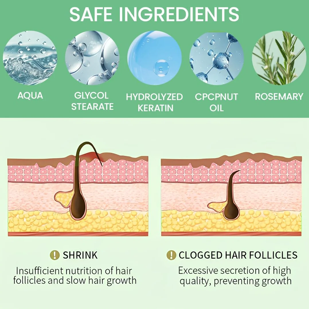 Shampoing Bio Au Romarin Pour La Pousse Des Cheveux, Fortifiant Naturel Pour Cheveux Fins Et Chute