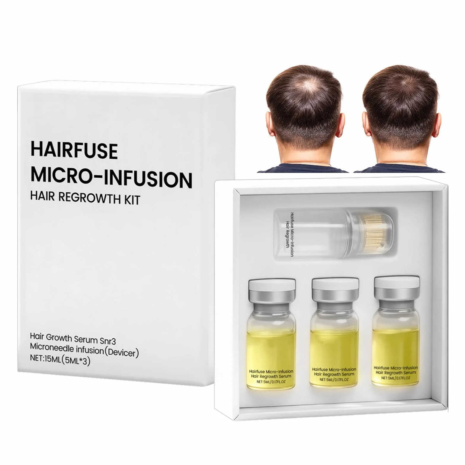 Micro Infusion Cheveux Colagea Repousse Cheveu Favorise Pousse Cheveux Plus Épais Fortifie Racines 5ml