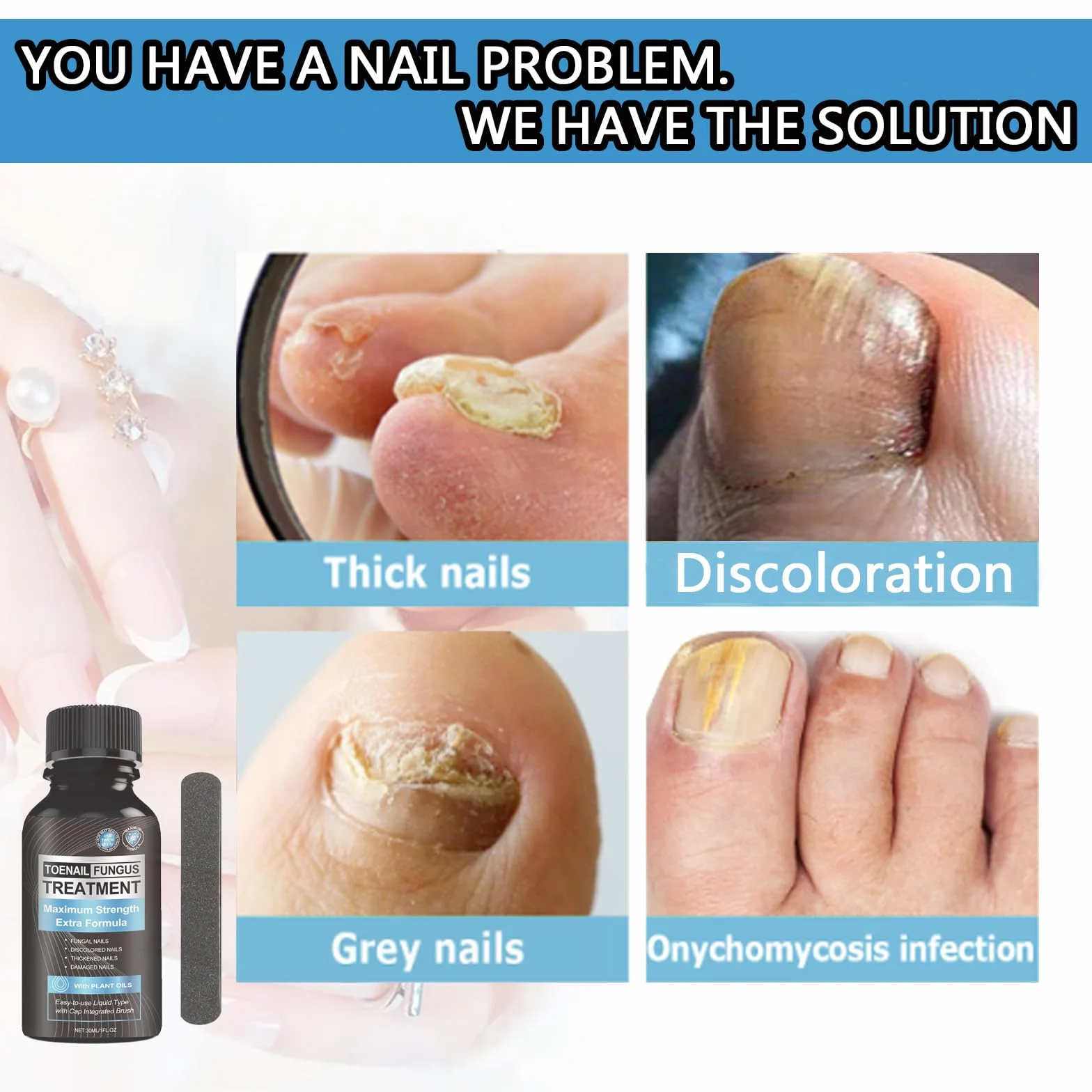 Toenail Fungus Treatment Extra Strength 30ML Nail Fungus Treatment for Damaged Nails