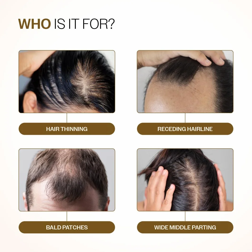 Bare Anatomy Sérum de Croissance des Cheveux Avancé Roll-On 25 ml 3% Rédensyl 4% Anagaine 2% Baïcapil 5% Romarin