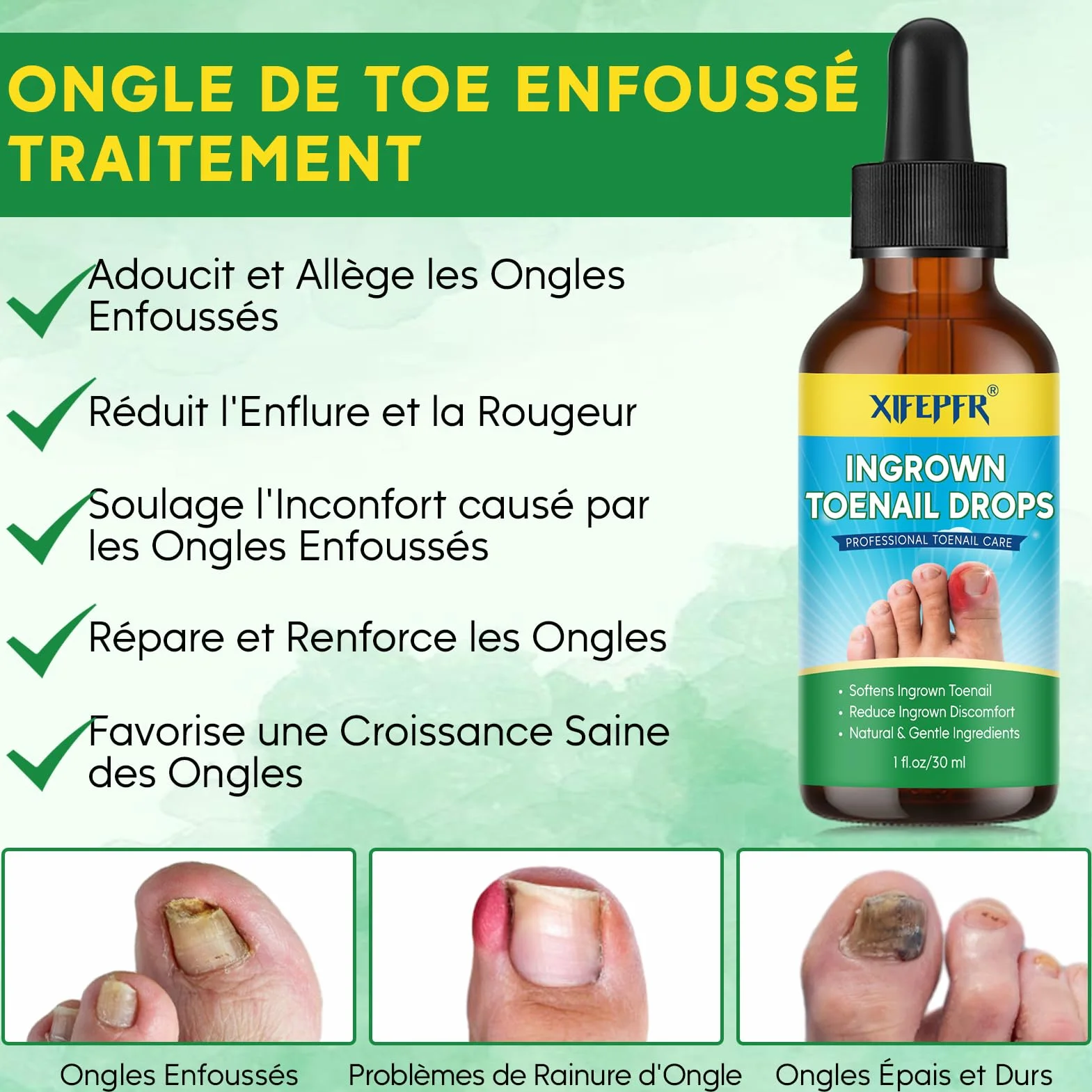 Kit d'Outils pour Ongle Incarné, Traitement Correcteur, Coupe Ongle et Pince Cuticule