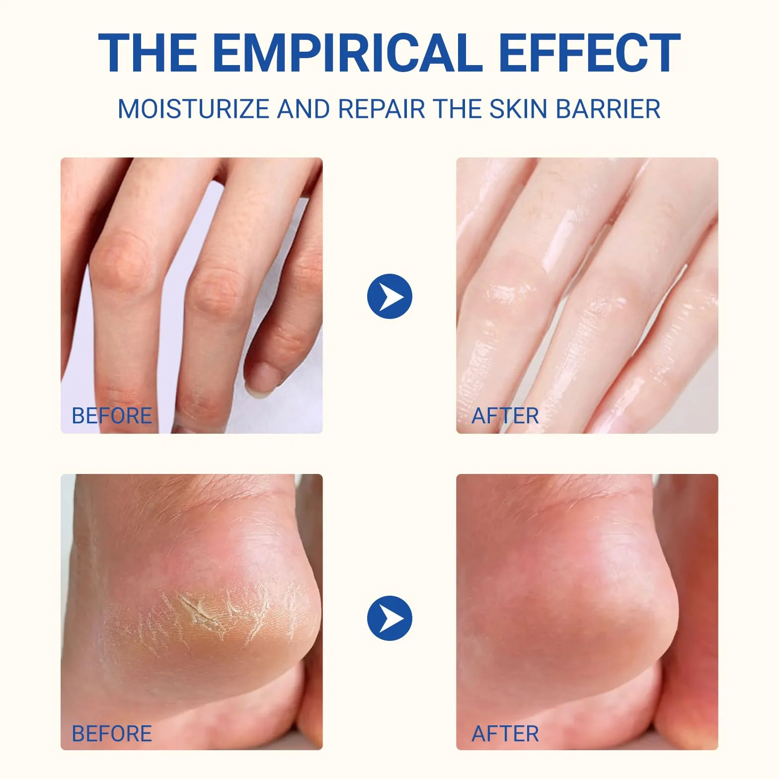 Crème à l'Urée 60% 40g pour Pieds Secs et Fissurés, Réparatrice Hydratante avec Aloe Vera