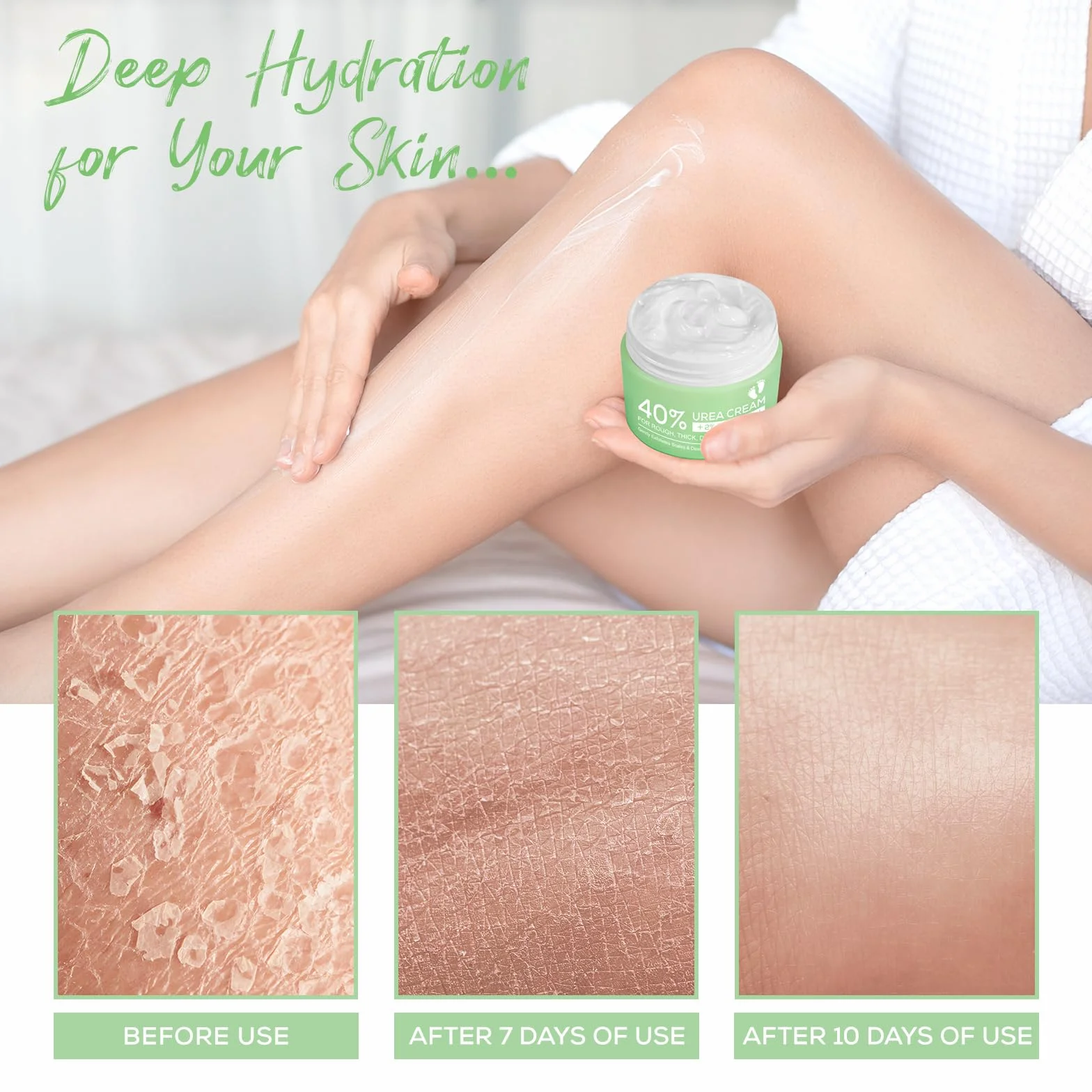 Crème d'urée 2% acide salicylique acide hyaluronique arbre à thé aloe vera hydratation profonde pieds mains talons coudes