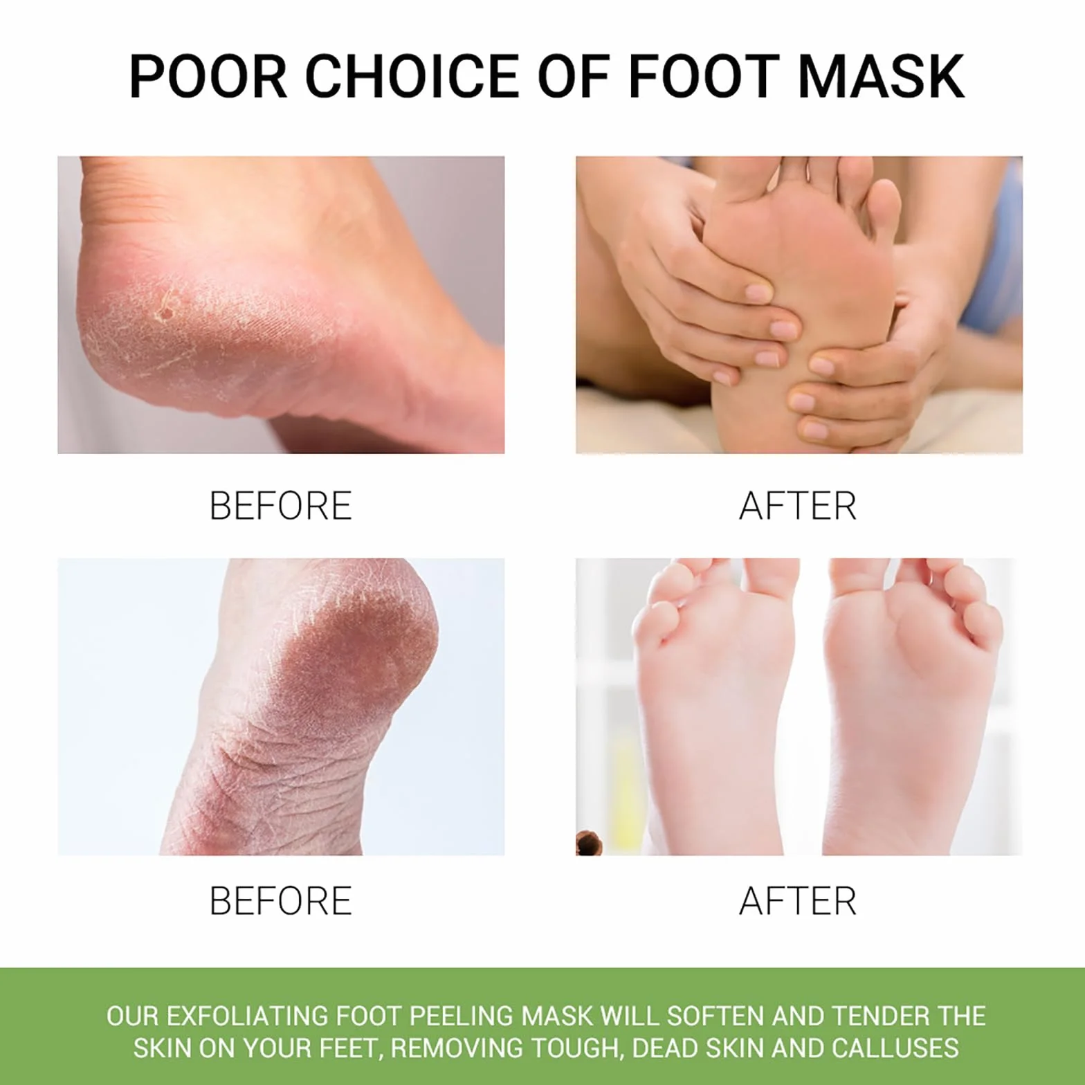 VolksRose Masque Pied à l'Aloe Vera 3 Pièces - Chaussettes Hydratant Réparateur Talons Fissurés
