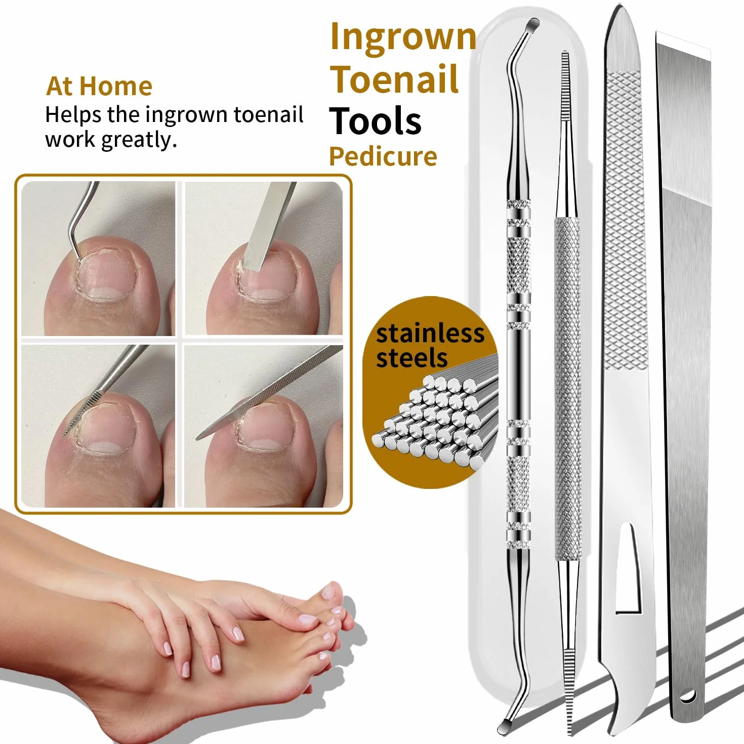 Kit d'enlèvement d'ongle incarné 6 pièces acier inoxydable coupe-ongles droits obliques incurvés outil pédicure