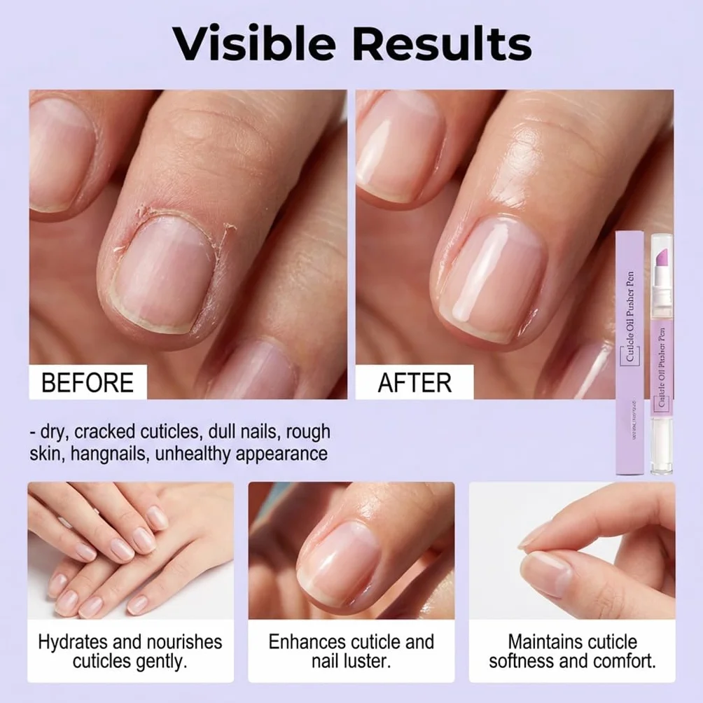 Stylo Repousse-Cuticules 2 en 1 - Cuticle Oil Pusher Pen with Ceramic Tip for Dry Cracked Nails