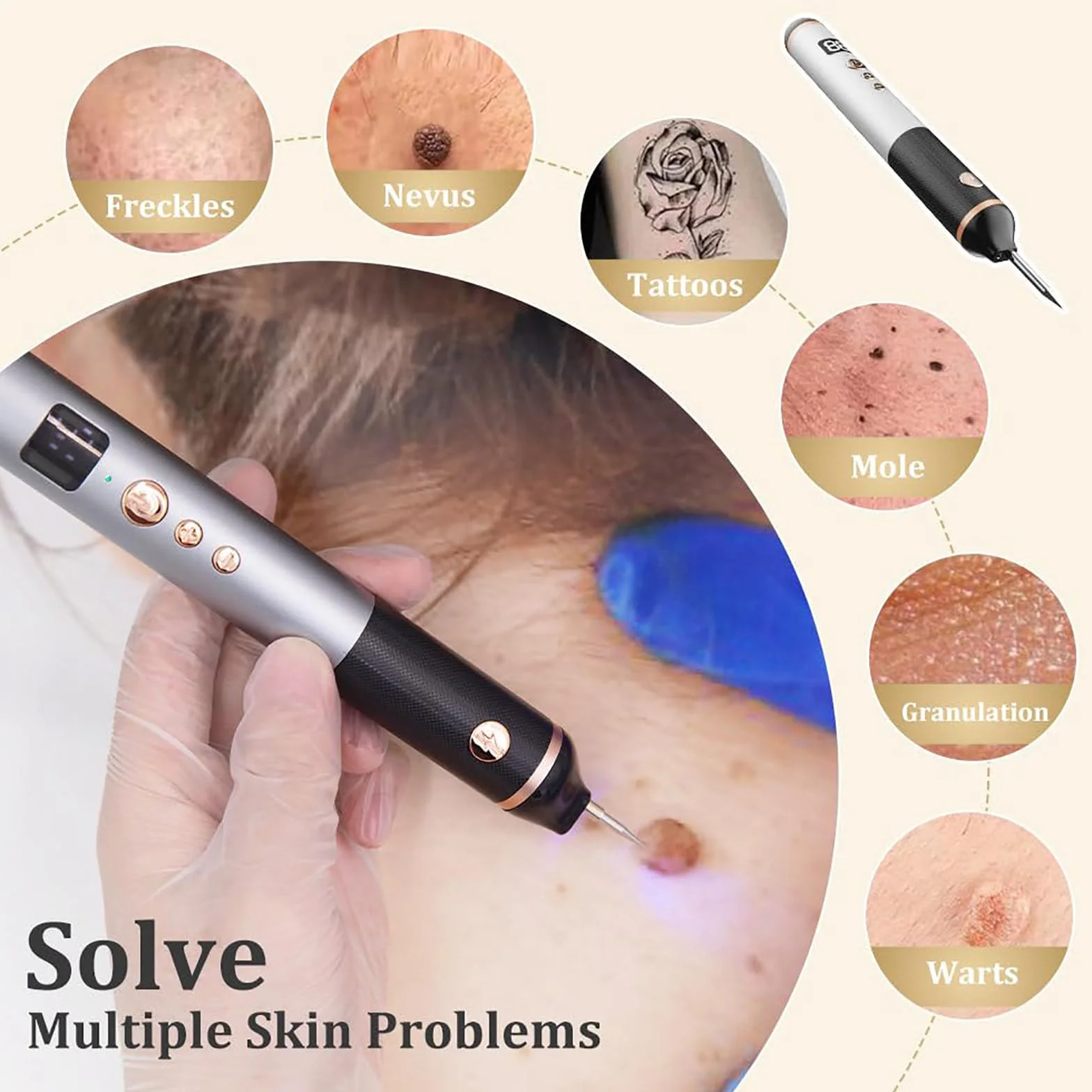Stylo Plasma à 15 Niveaux pour Éliminer Acrochordons, Taches, Grains de Beauté, Verrues