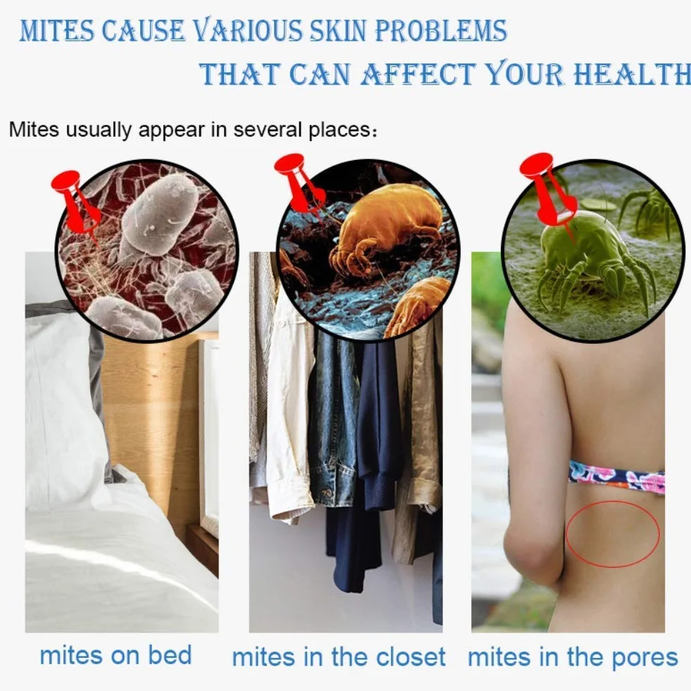Savon Lait de Chèvre au Sel de Mer Exfoliant Anti Acné Cicatrices Points Noirs Visage Corps