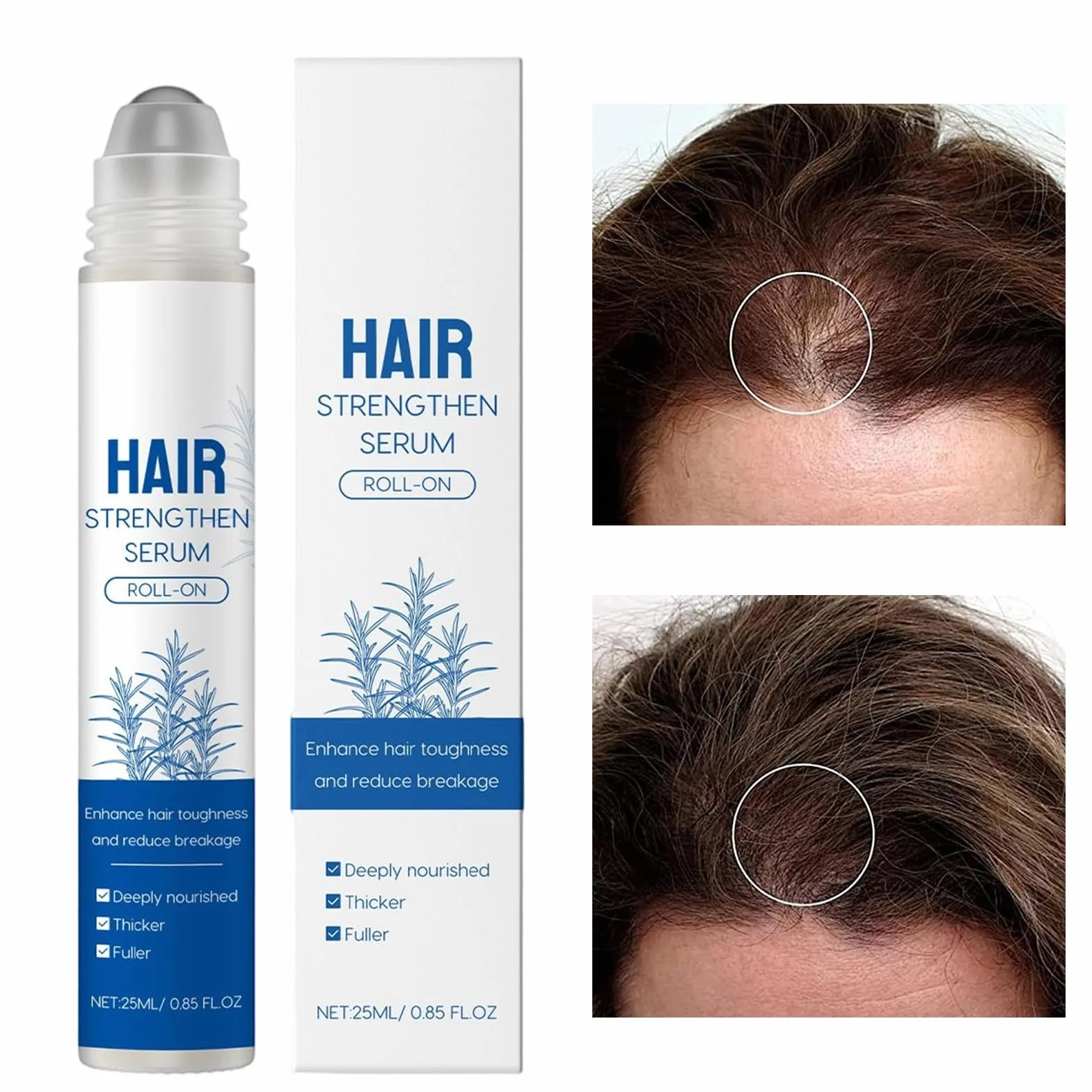 Sérum de croissance des cheveux 25 ml Stylo nourrissant Solution rouleau soin cuir chevelu