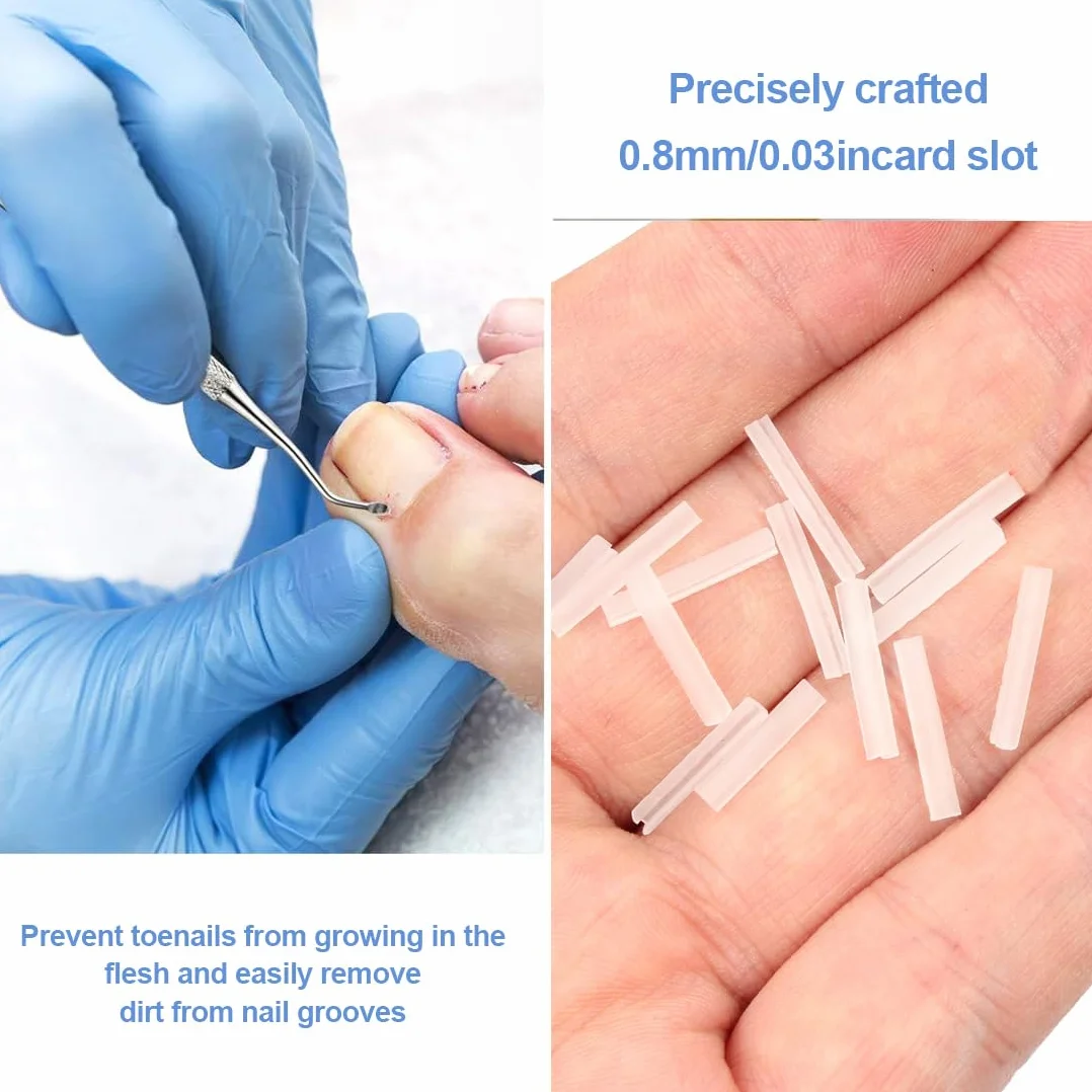 Kit correcteur d'ongles incarnés 50 bandes de redressement avec lève-ongles