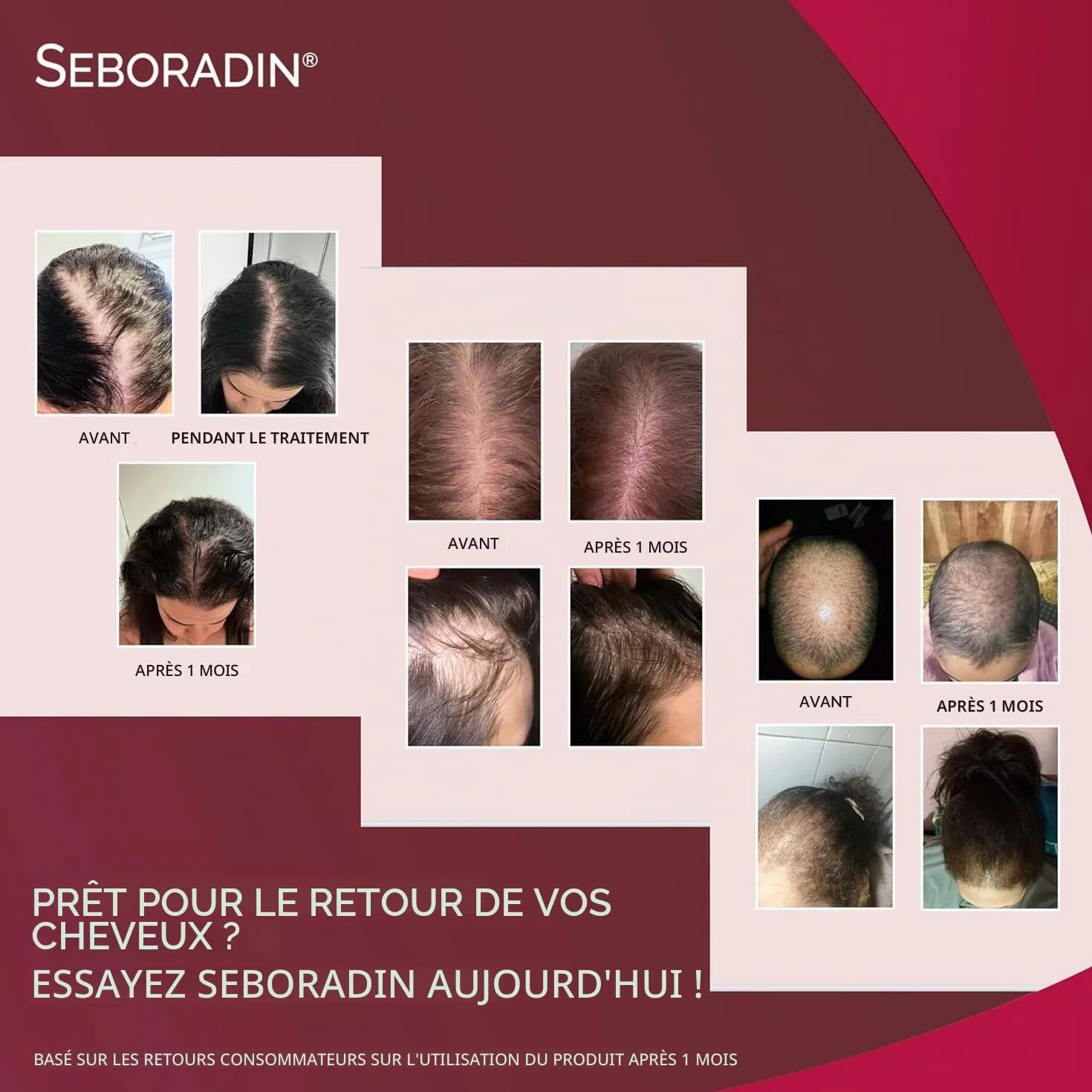 Seboradin Ampoules Forte, Sérum Capillaire Anti-Chute Cheveux, 14 x 5,5 ml