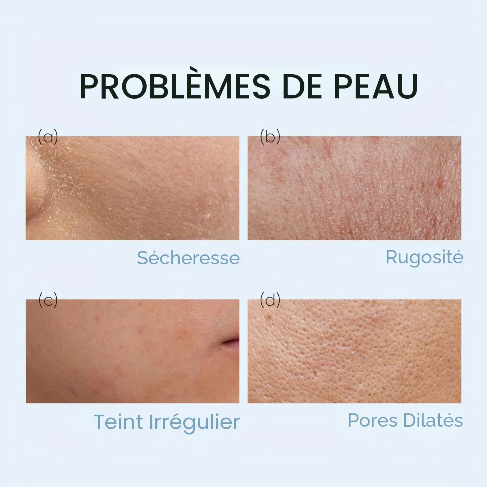 LAIKOU Milk Skincare Set 18 Pièces Coffret Soin Visage Format Voyage