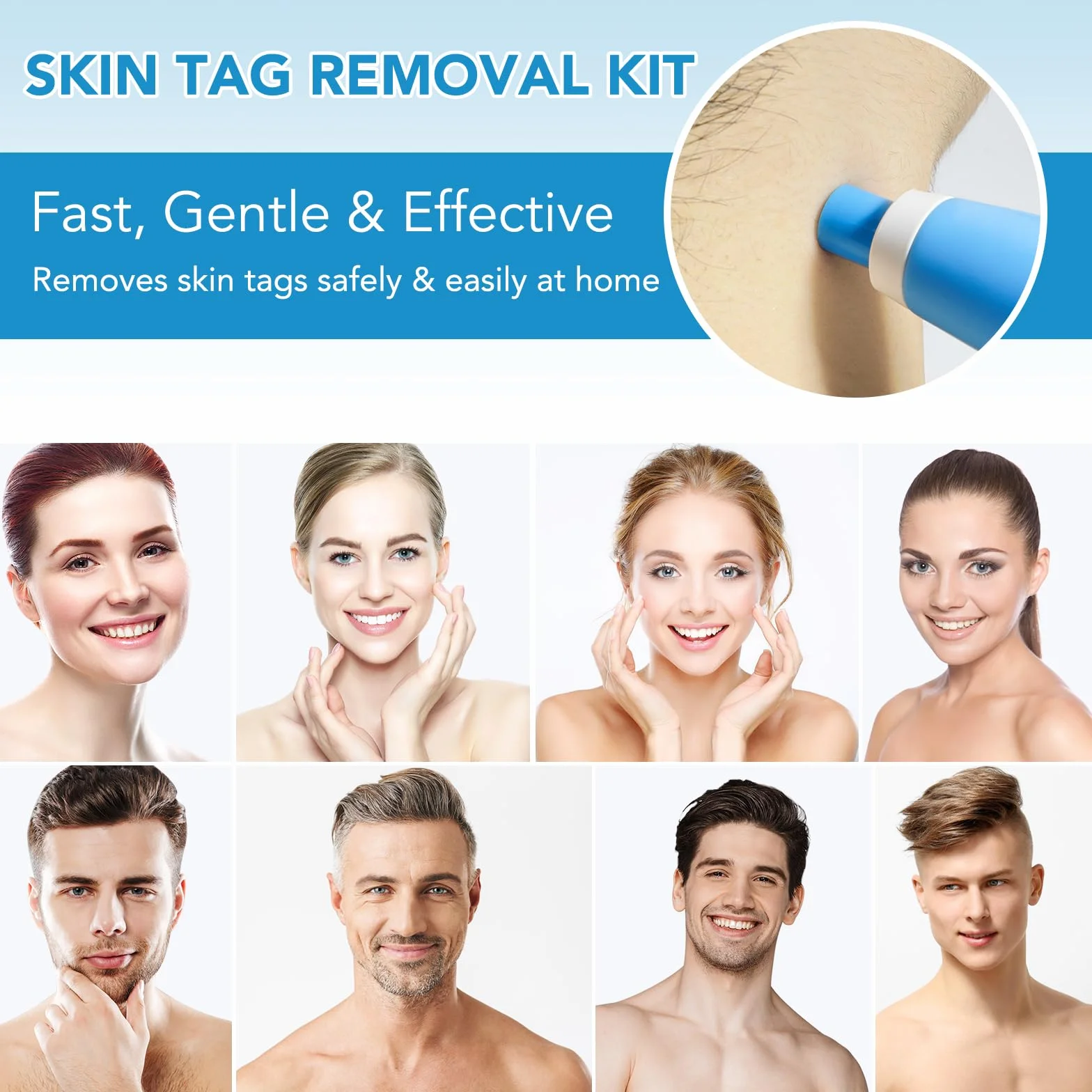 Kit de Traitement Acrochordons, Stylo d'Élimination Automatique 2 Tailles, Efficace et Indolore – Verrues et Grains de Beauté 2-8mm