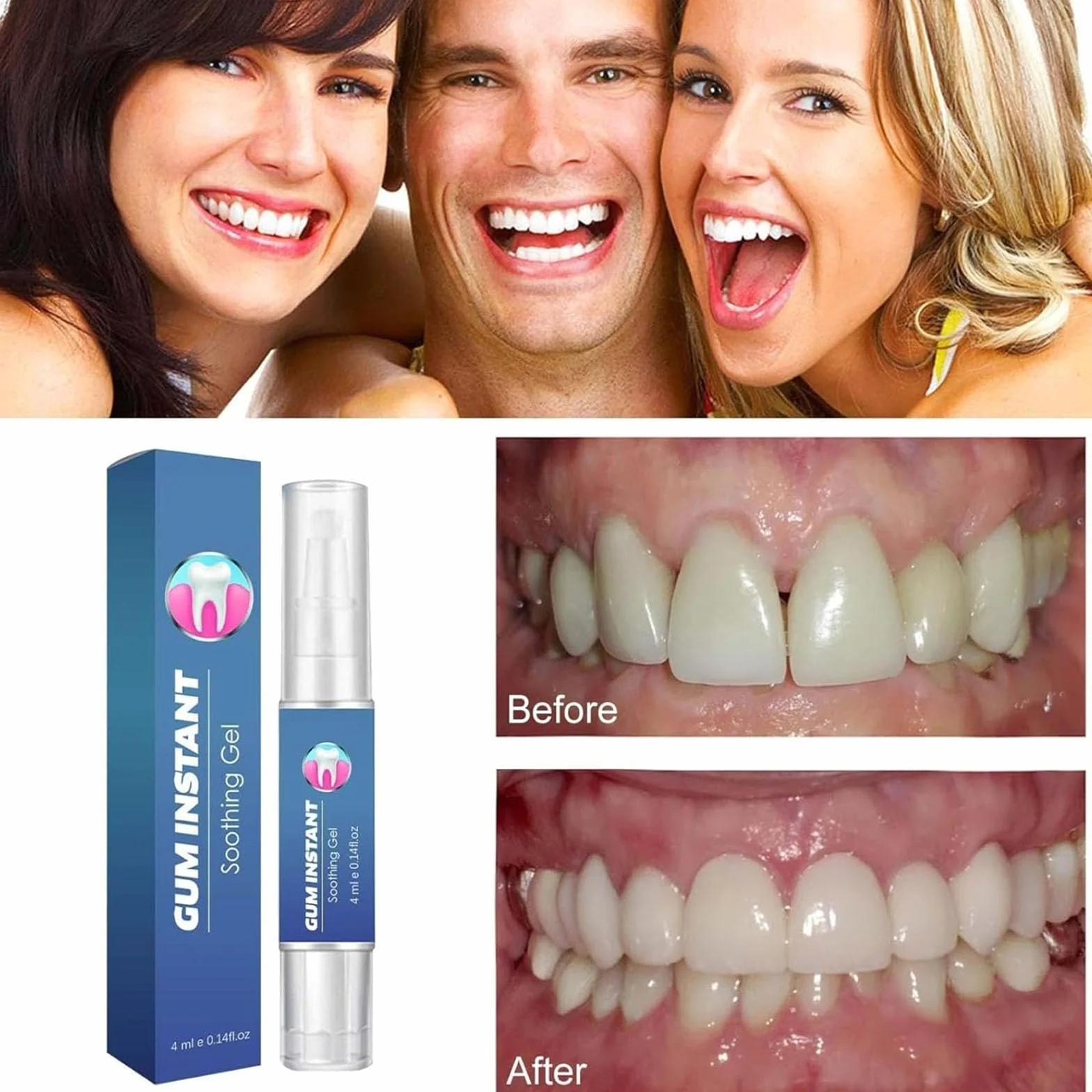GumEase Gel réparateur dentaire apaisant pour gencives, Haleine fraîche (3Pcs)
