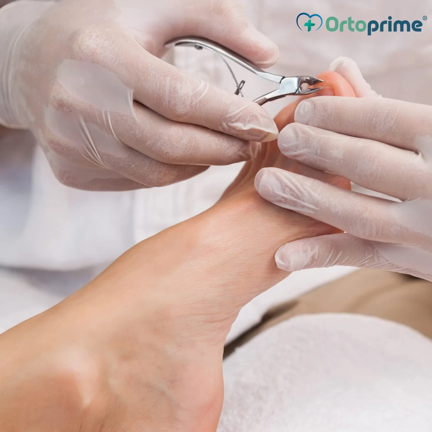 OrtoPrime Pince Coupe-ongle Professionnel - Ongles Incarnés Pieds Adultes