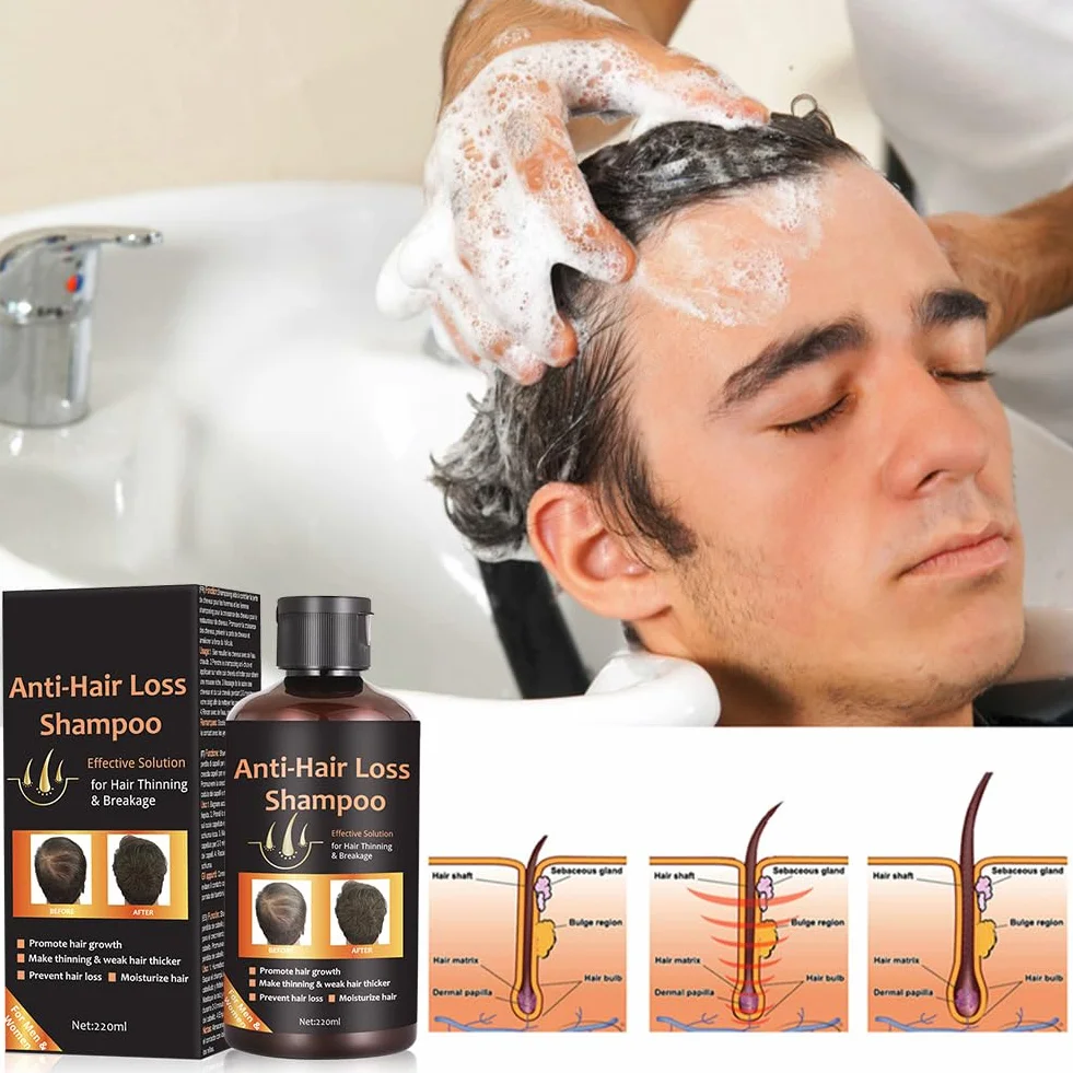 Shampoing Croissance Cheveux Anti Chute Hommes Femmes, 220ml