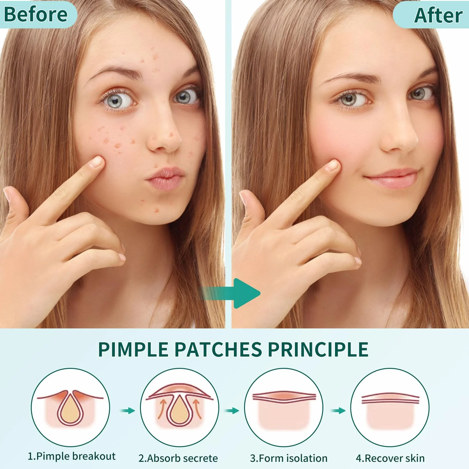 Patch Boutons Acne 360 Pièces, 3 Tailles Pimple Patch Star avec Huile Tea Tree et Acide Salicylique, Hydrocolloïdes Imperméables
