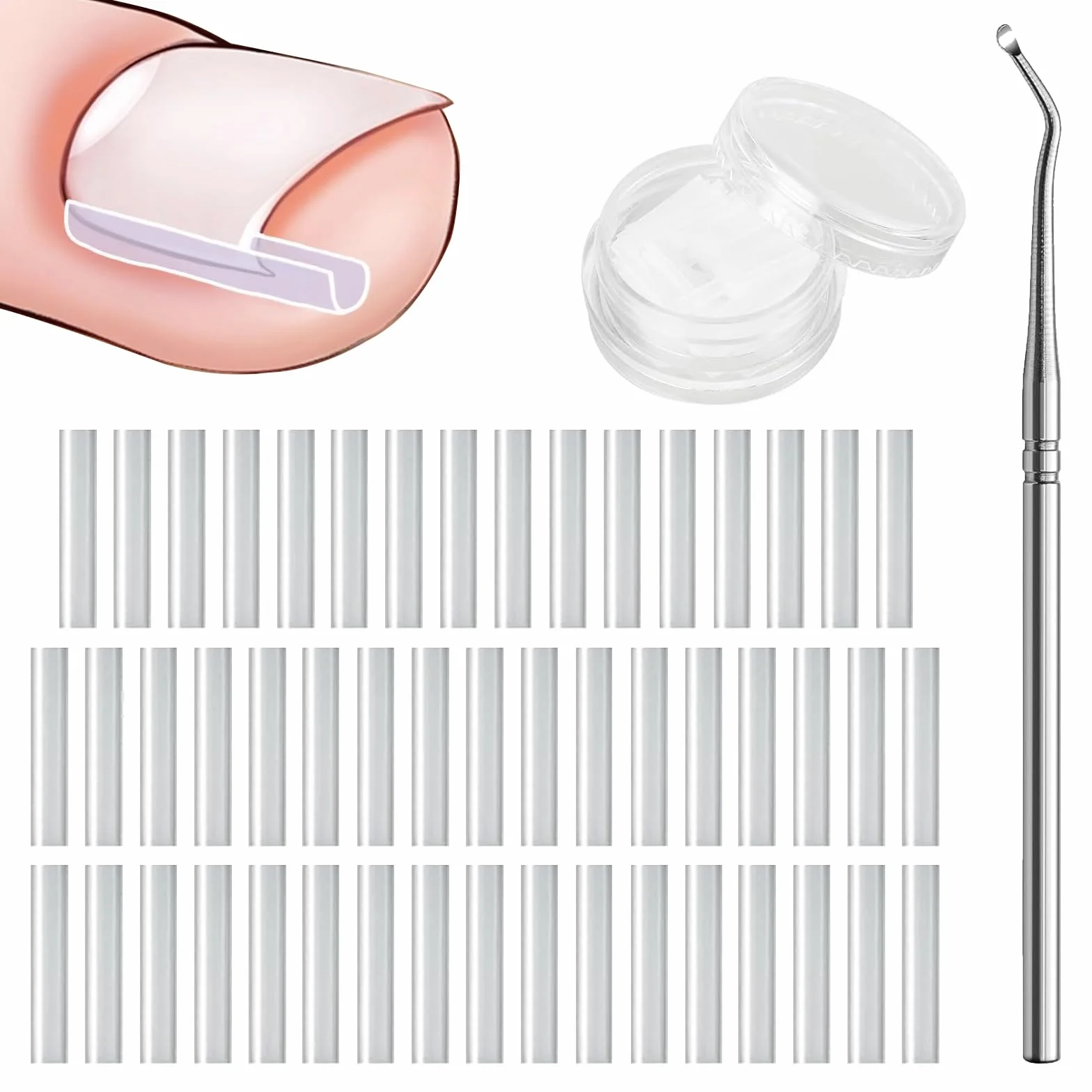 Ensemble Correcteur d'Ongles Incarnés 50 Bandes Sans Douleur Kit Outils