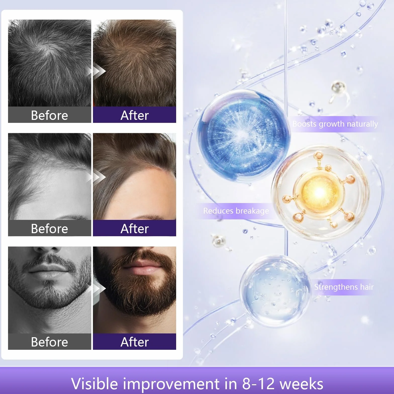 Serum Pousse Cheveux Biotine Romarin Batana Oil Spray Croissance Capillaire Anti Chute Cheveux Femme Homme 60ml