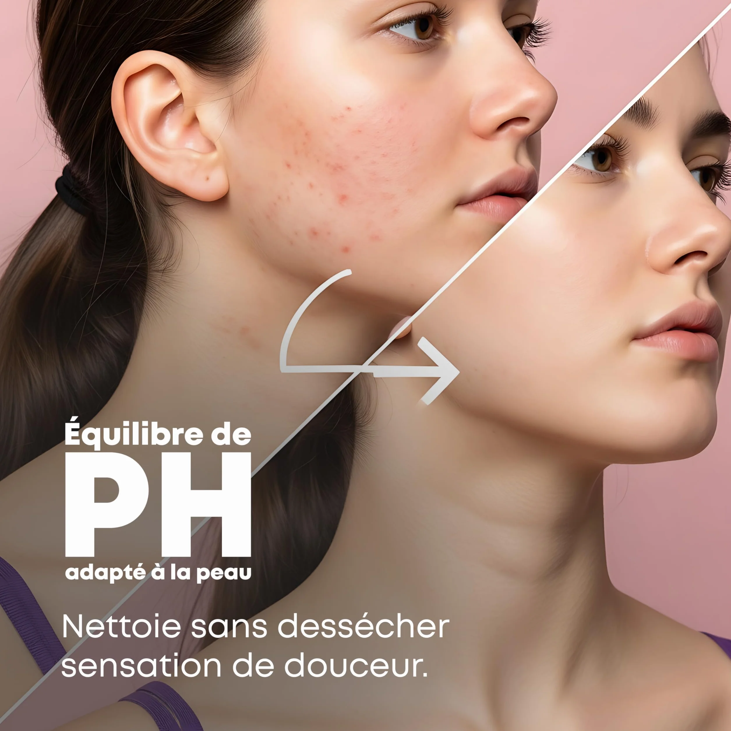 Savon Lait de Chevre PhytoFlora Anti-Acné Eczéma Points Noirs 125g Shampoing Solide Gommage Visage Provitamine B5