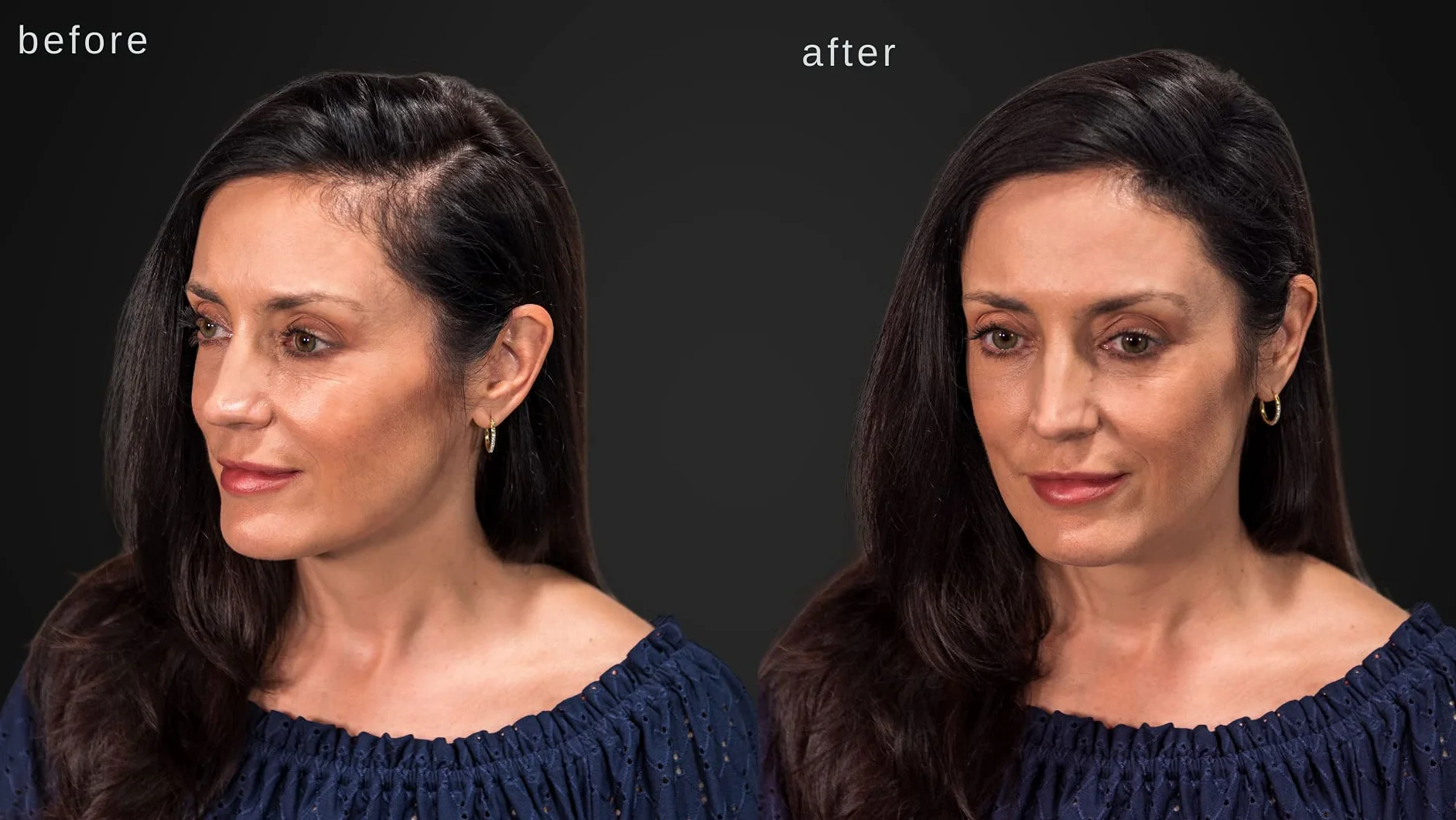 Hypoallergénique fibres épaississantes cheveux Marron foncé testé dermatologues