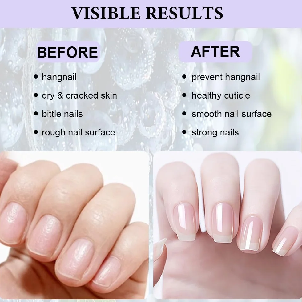 LOPHE Huile pour Cuticules et Ongles 15 ml - Soin Renforçant et Adoucissant pour Mains Douces et Ongles Brillants
