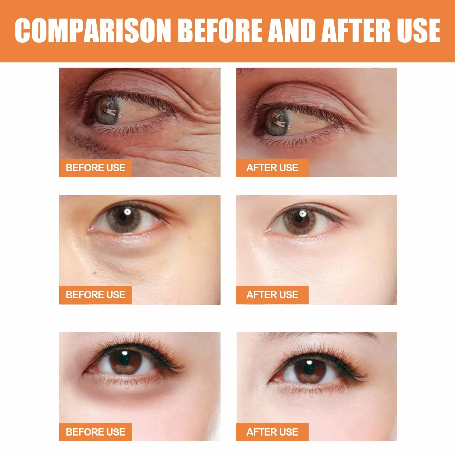 Baume pour les yeux à la vitamine C éclaircit et réduit les poches, Stick hydratant MultiCorrexion