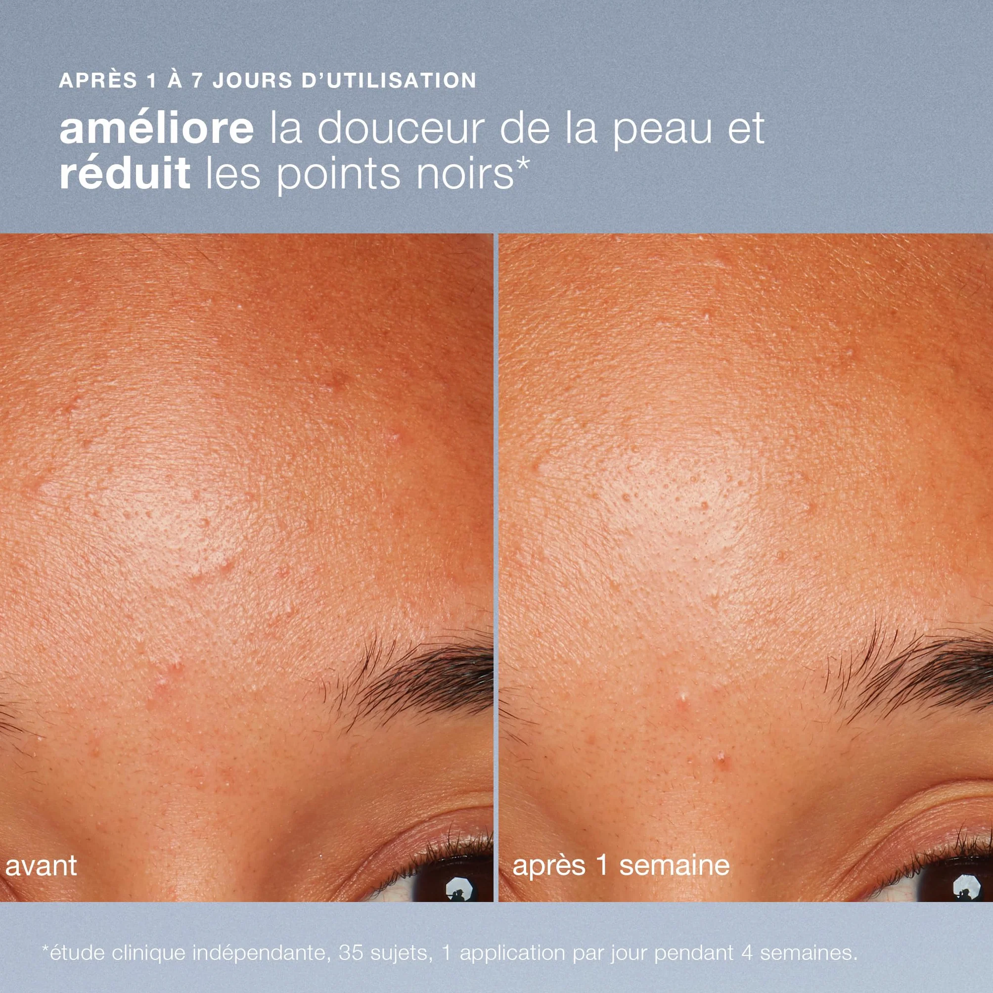 Dermalogica Daily Microfoliant - Exfoliant doux iconique à la poudre de riz pour lisser et illuminer le teint