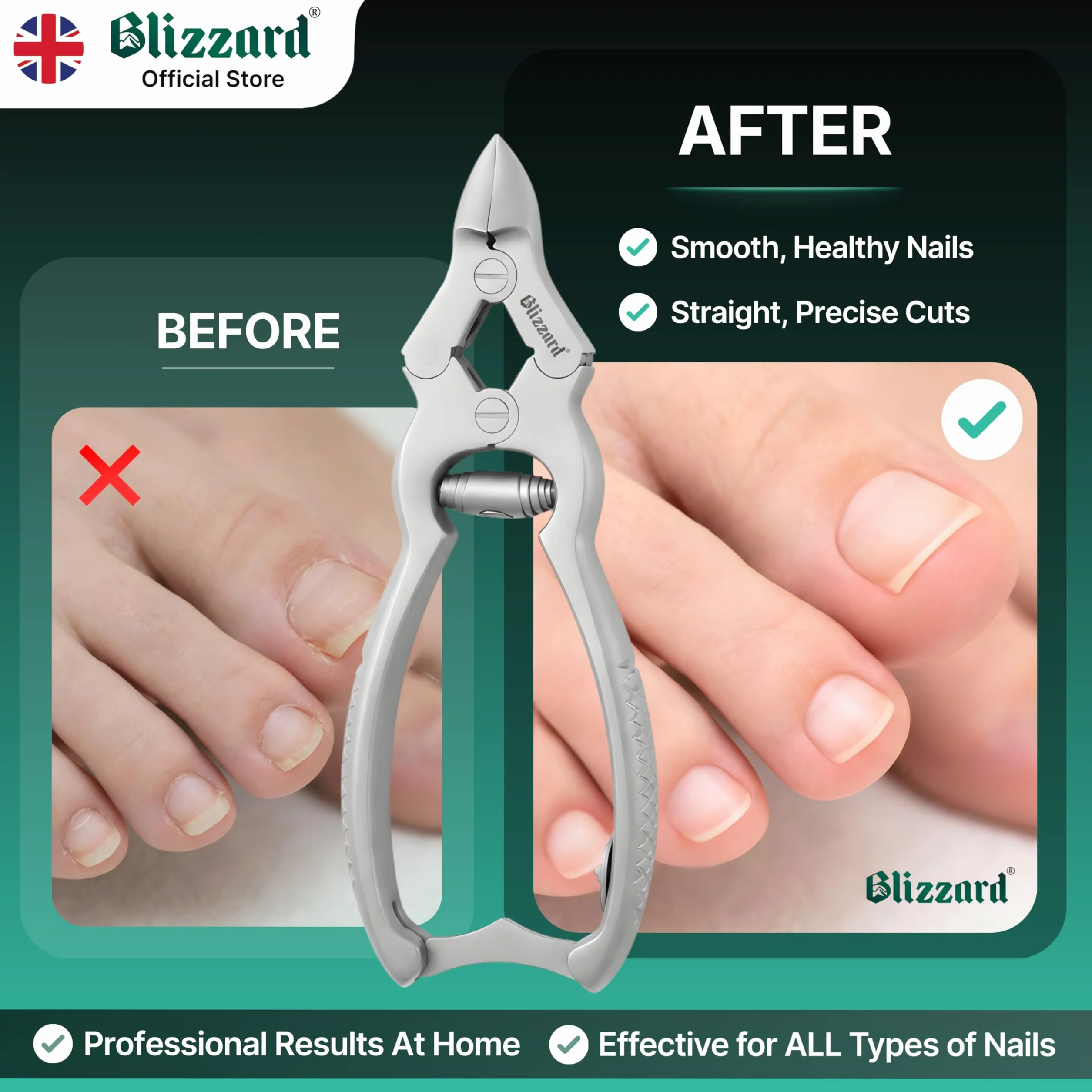 Blizzard Coupe-Ongles Professionnel Acier Inox 15cm pour Ongles Épais et Incarnés