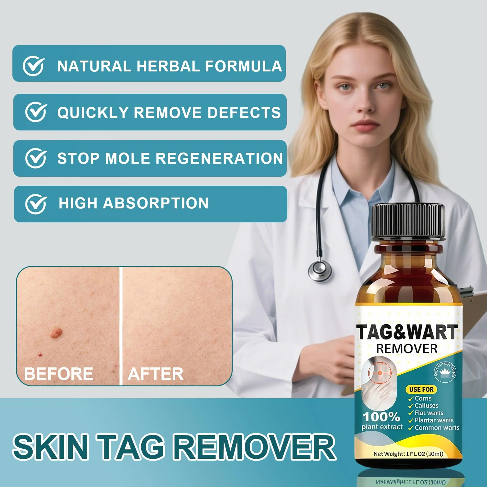 Skin Tag Remover 30ml, Fluide de Soin pour Peau Mains et Pieds, Peau Lisse