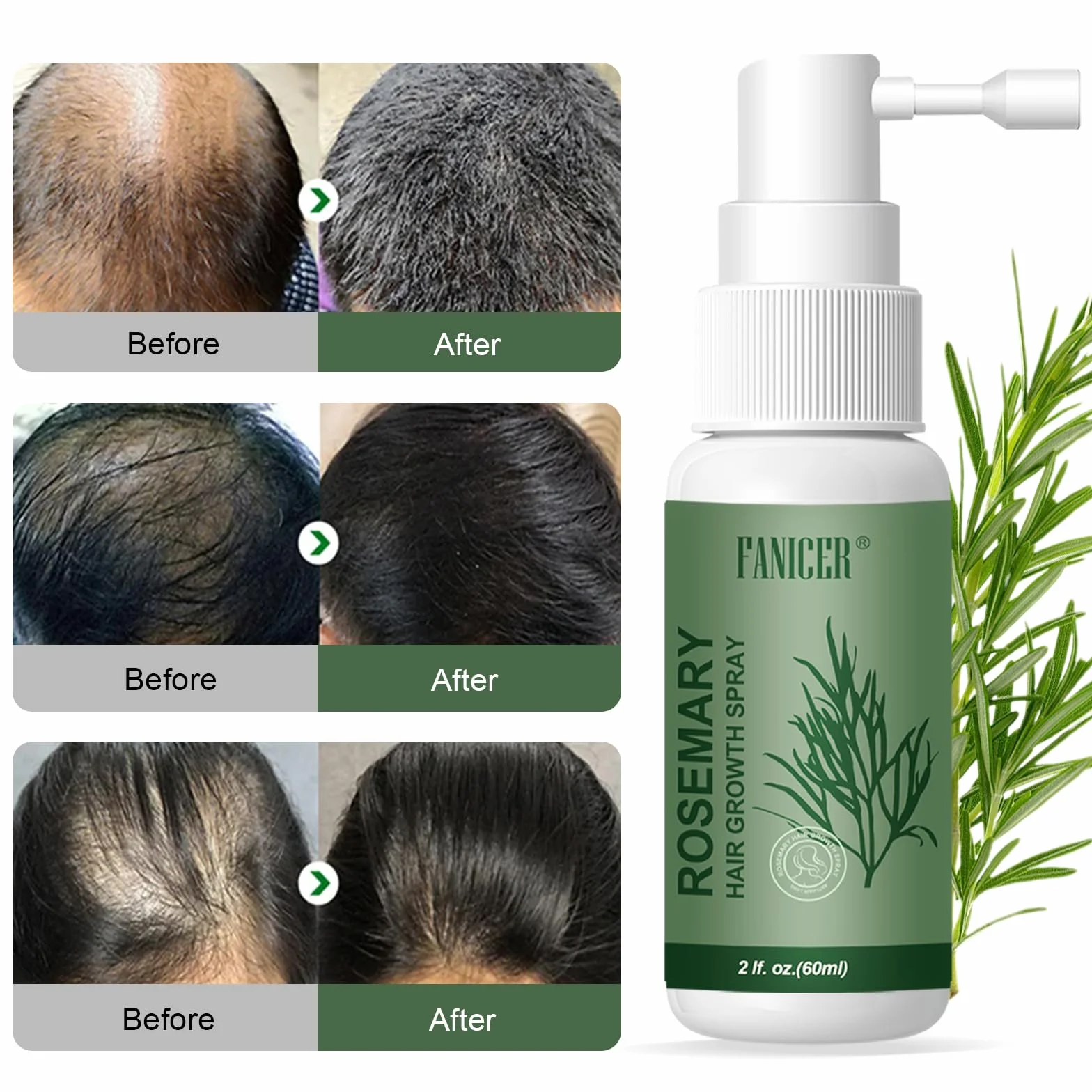 Serum Pousse Cheveux à Huile Essentielle de Romarin pour Croissance Rapide 60ml