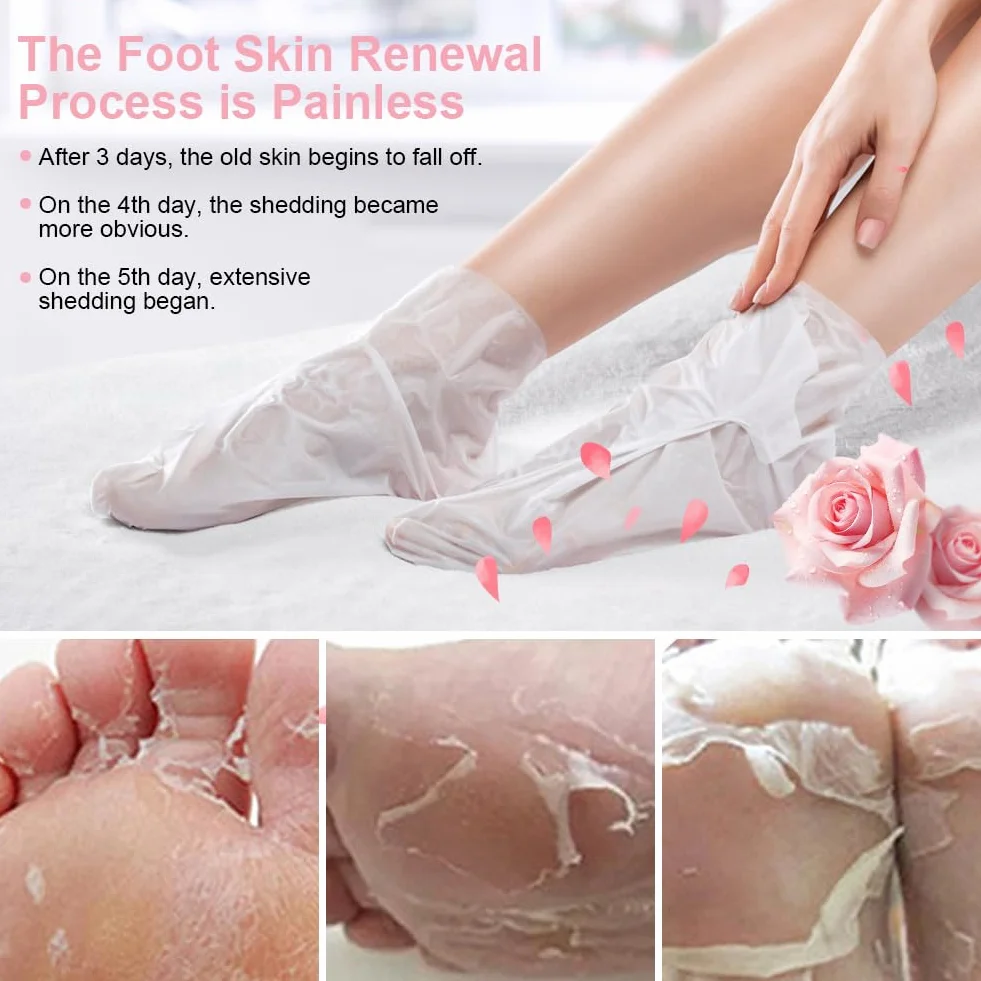Masque Pieds Peeling Exfoliant 4 Paires Hydratant Rose Chaussette Exfoliante Nourrissant Callosités Crevasses Pieds Secs