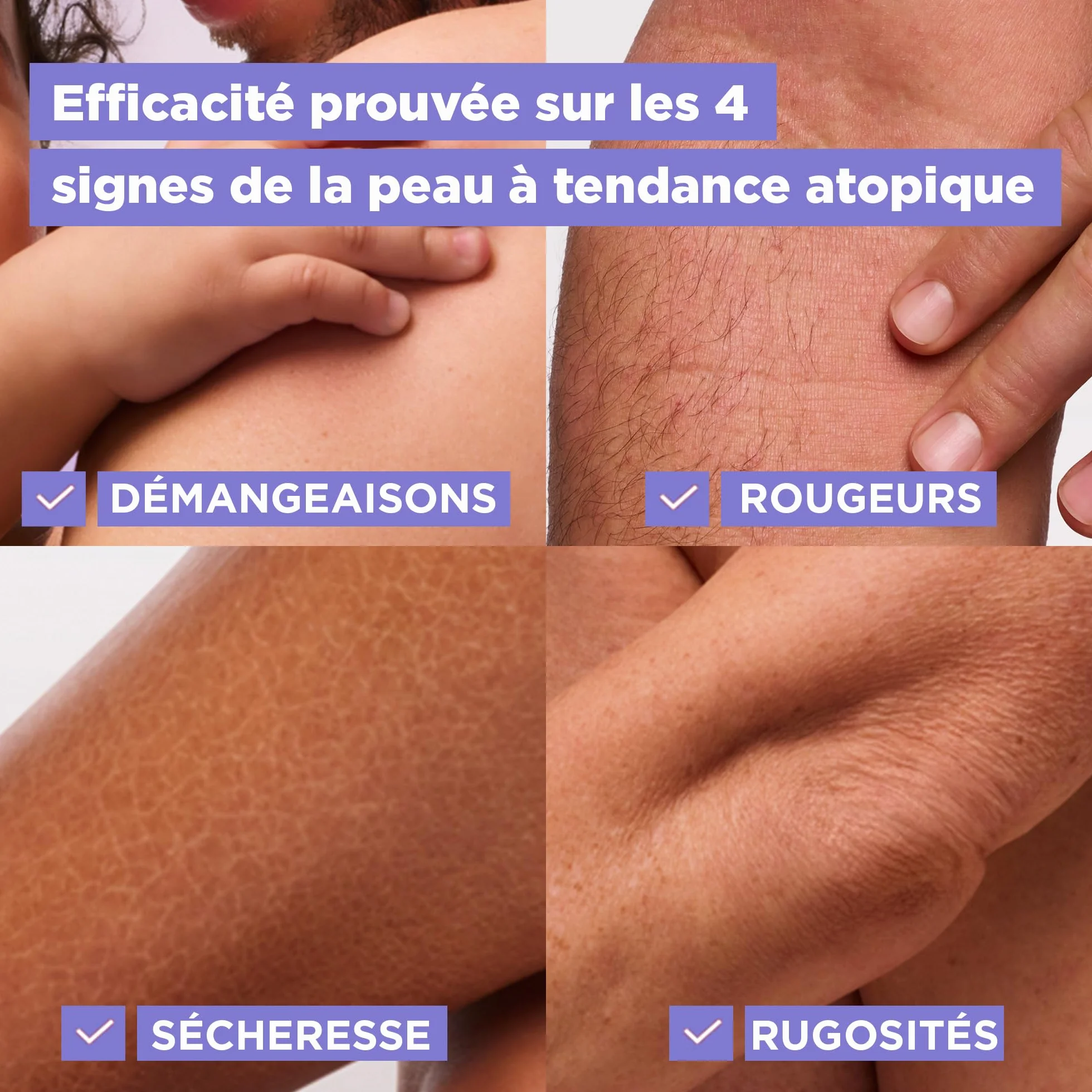 Mixa Crème Panthénol Confort Anti-Démangeaisons Peaux Très Sèches Hypoallergénique Sans Parfum 400ml