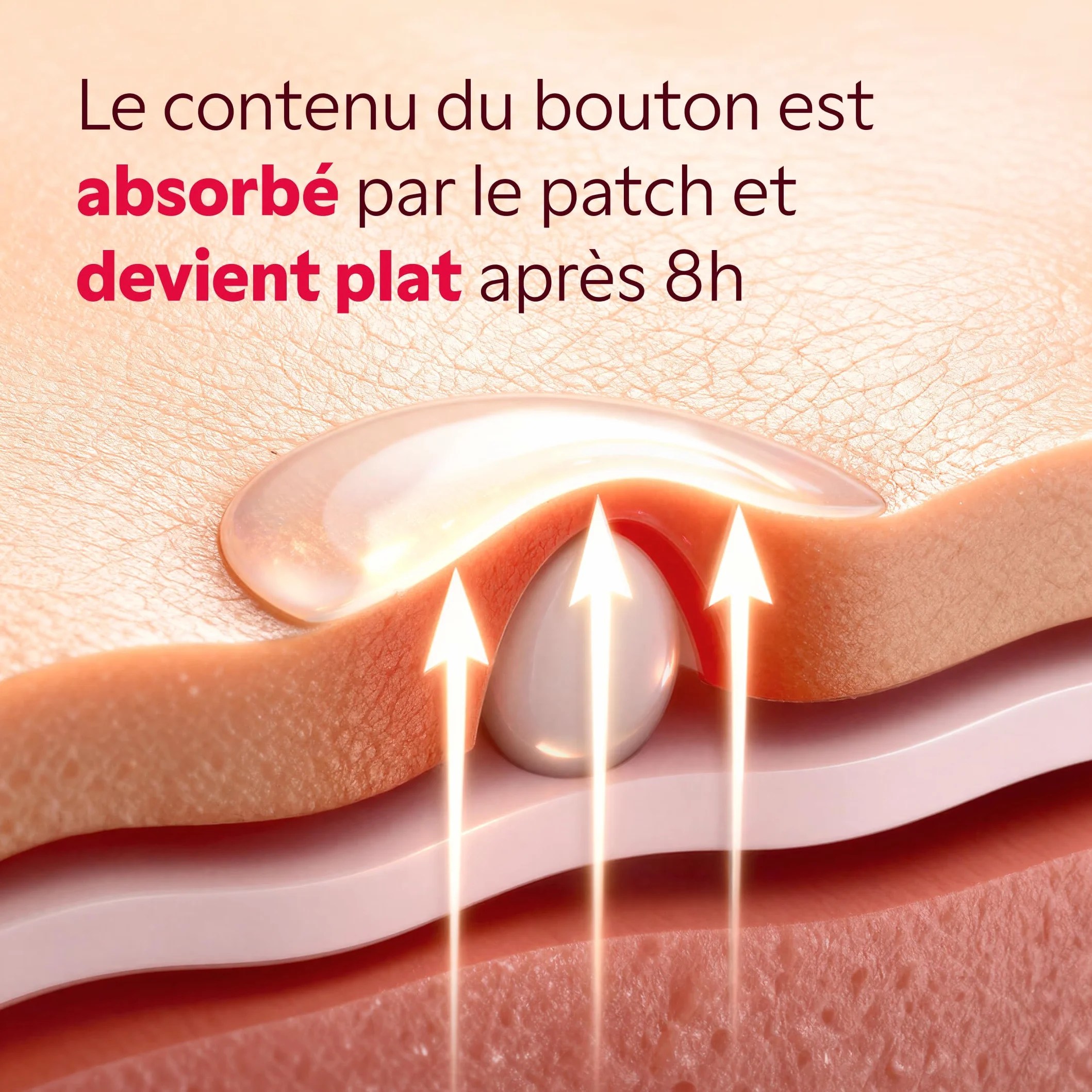 My SOS Beauty Pack de 36 Patchs Hydrocolloïde Anti-Boutons Invisible