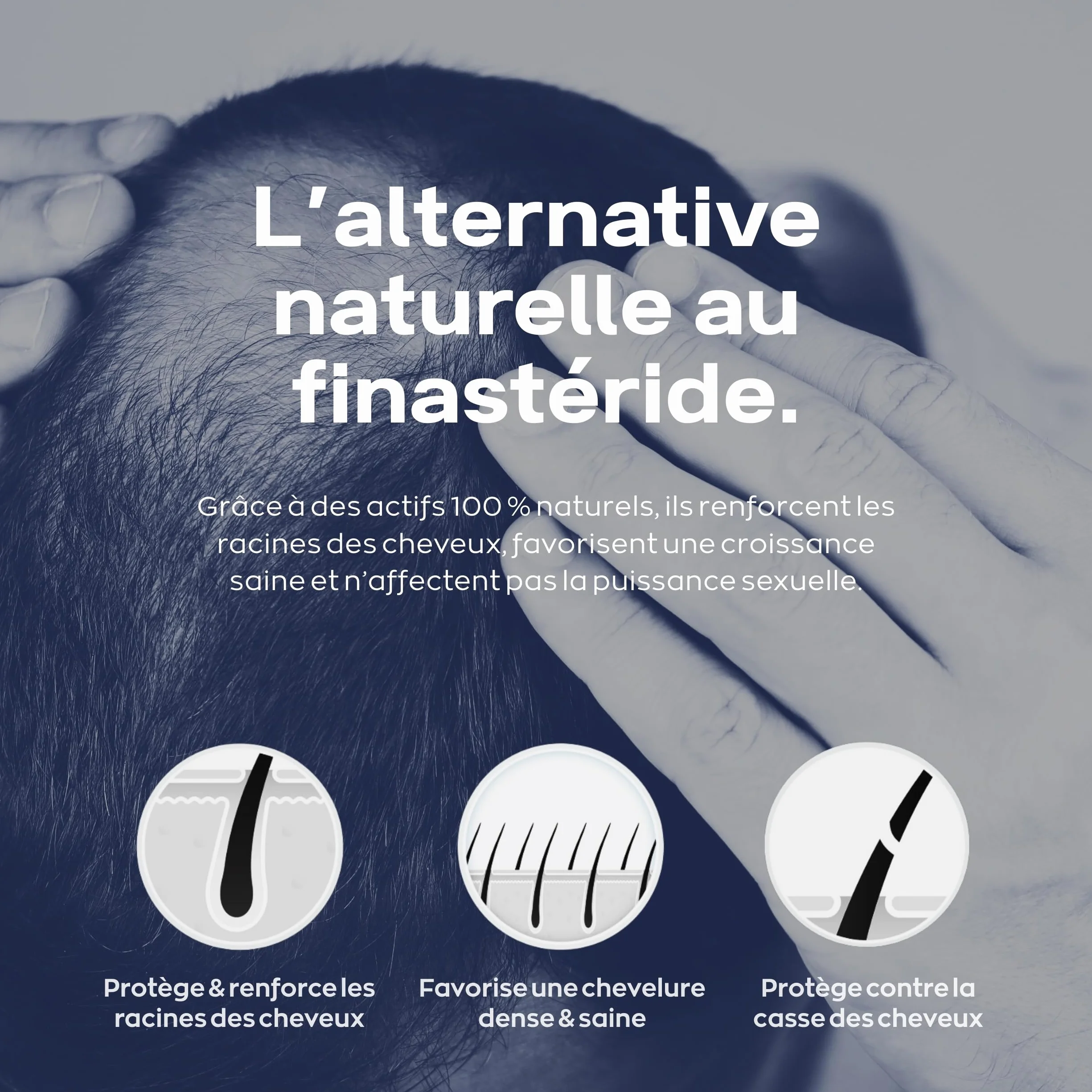 XPECIA Comprimés contre la chute des cheveux, bloque DHT, croissance cheveux 120 Unité (Lot de 2 boites de 60)