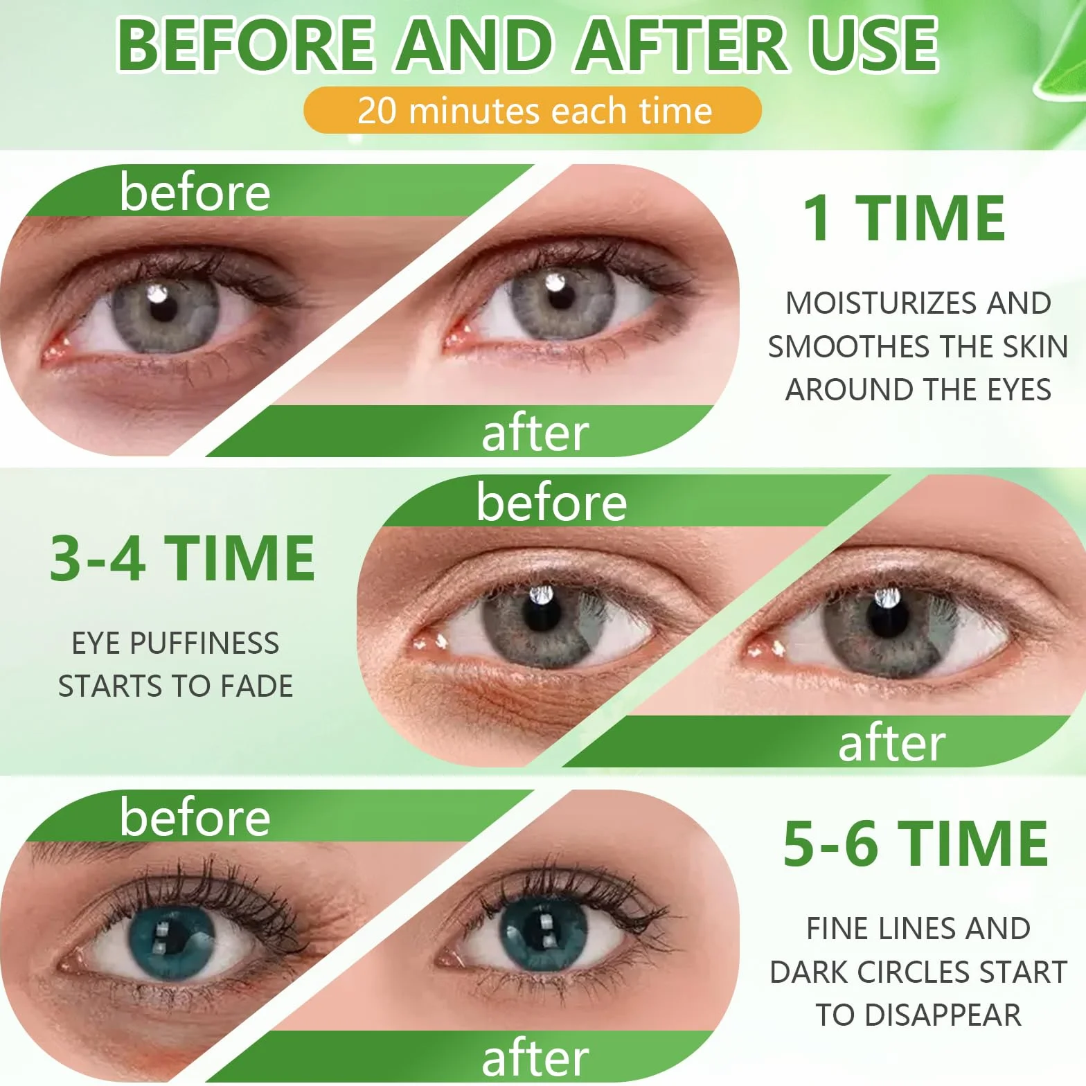Patch Yeux Aloe Vera Acide Hyaluronique Collagène 60 Pièces Anti Cernes Poches Rides